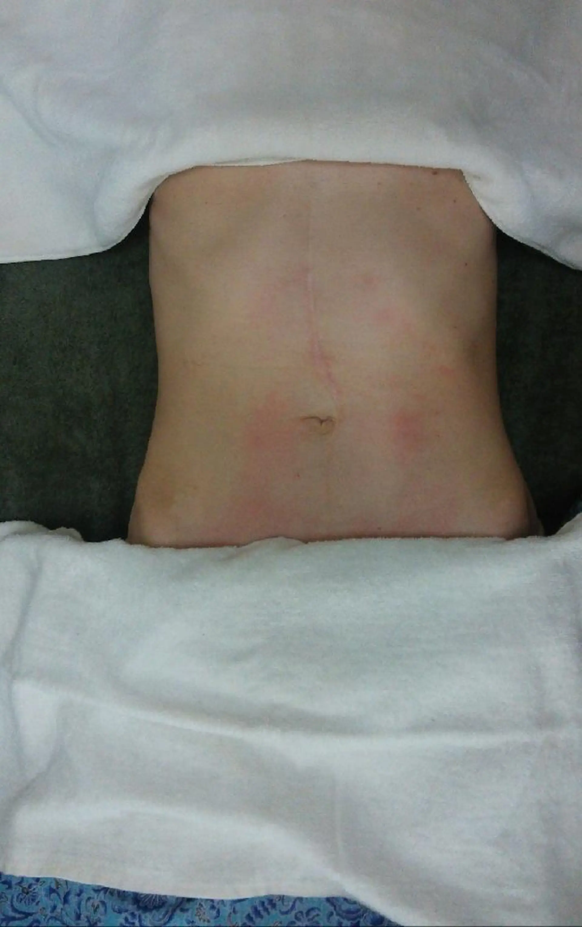 リラクゼーション 森の中の木の実のエステ・リラクイメージ