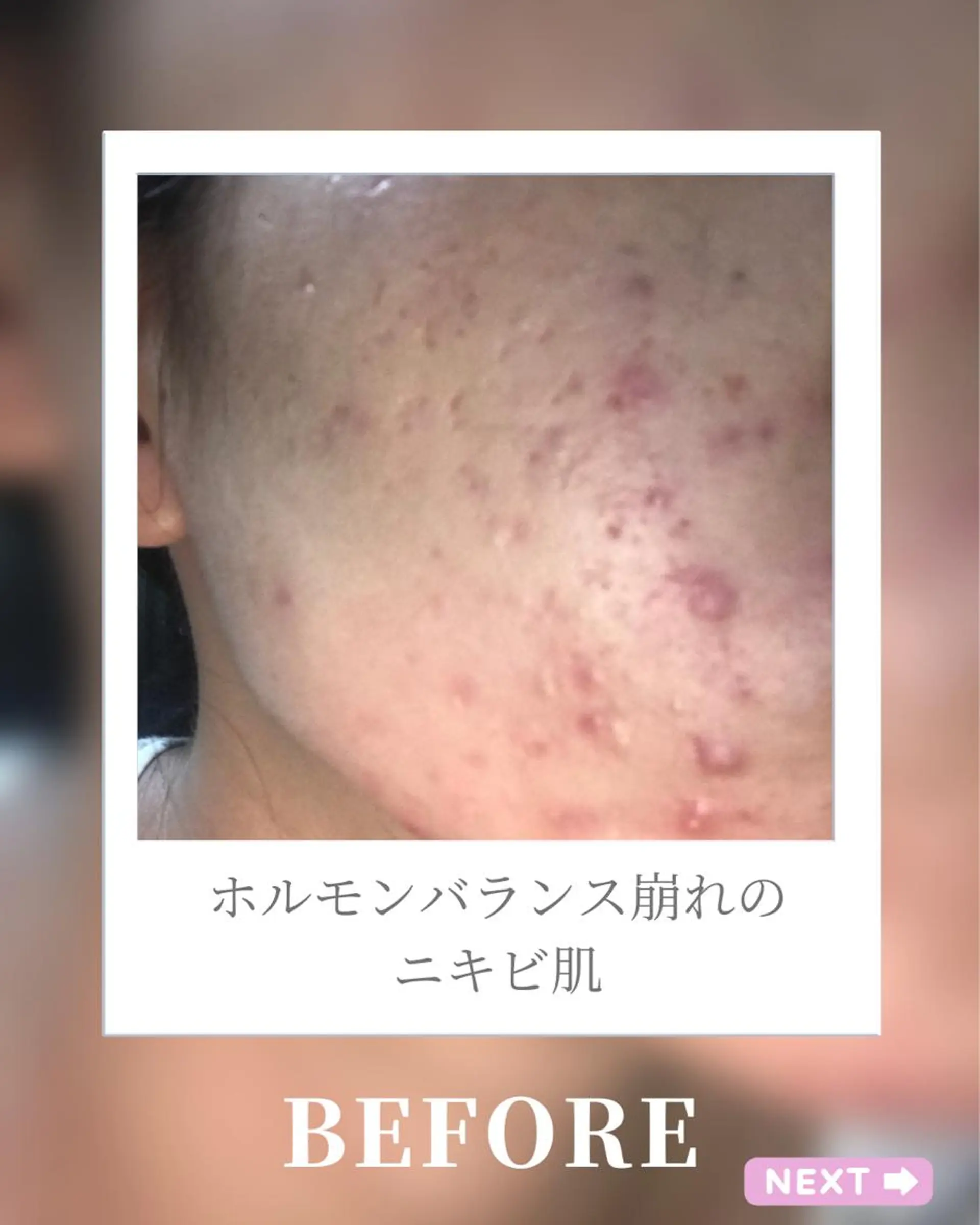 🎀BiBi韓国美容 コスパ強！美活サロンのエステ・リラクイメージ