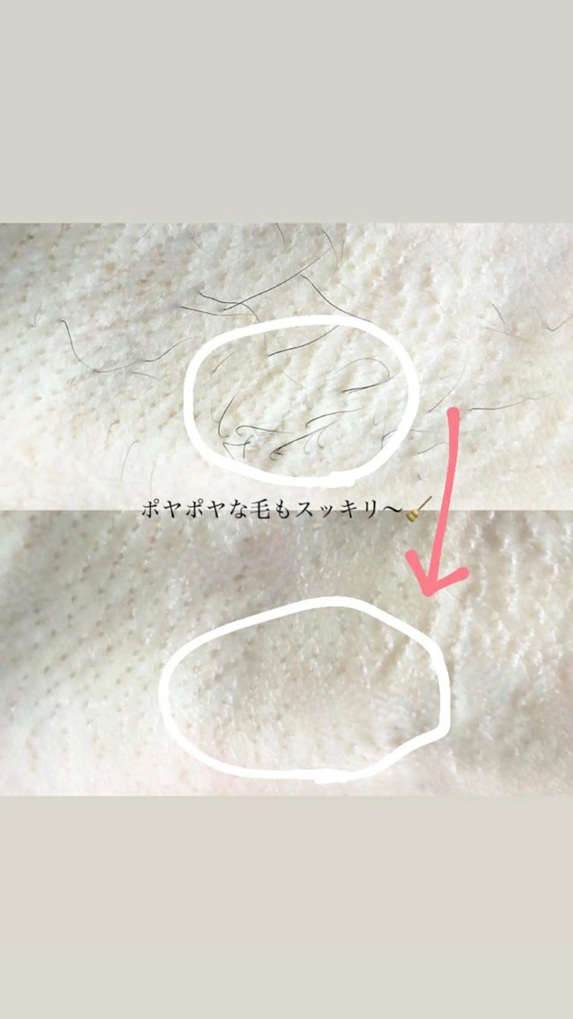 脱毛 &me ayakaのエステ・リラクイメージ