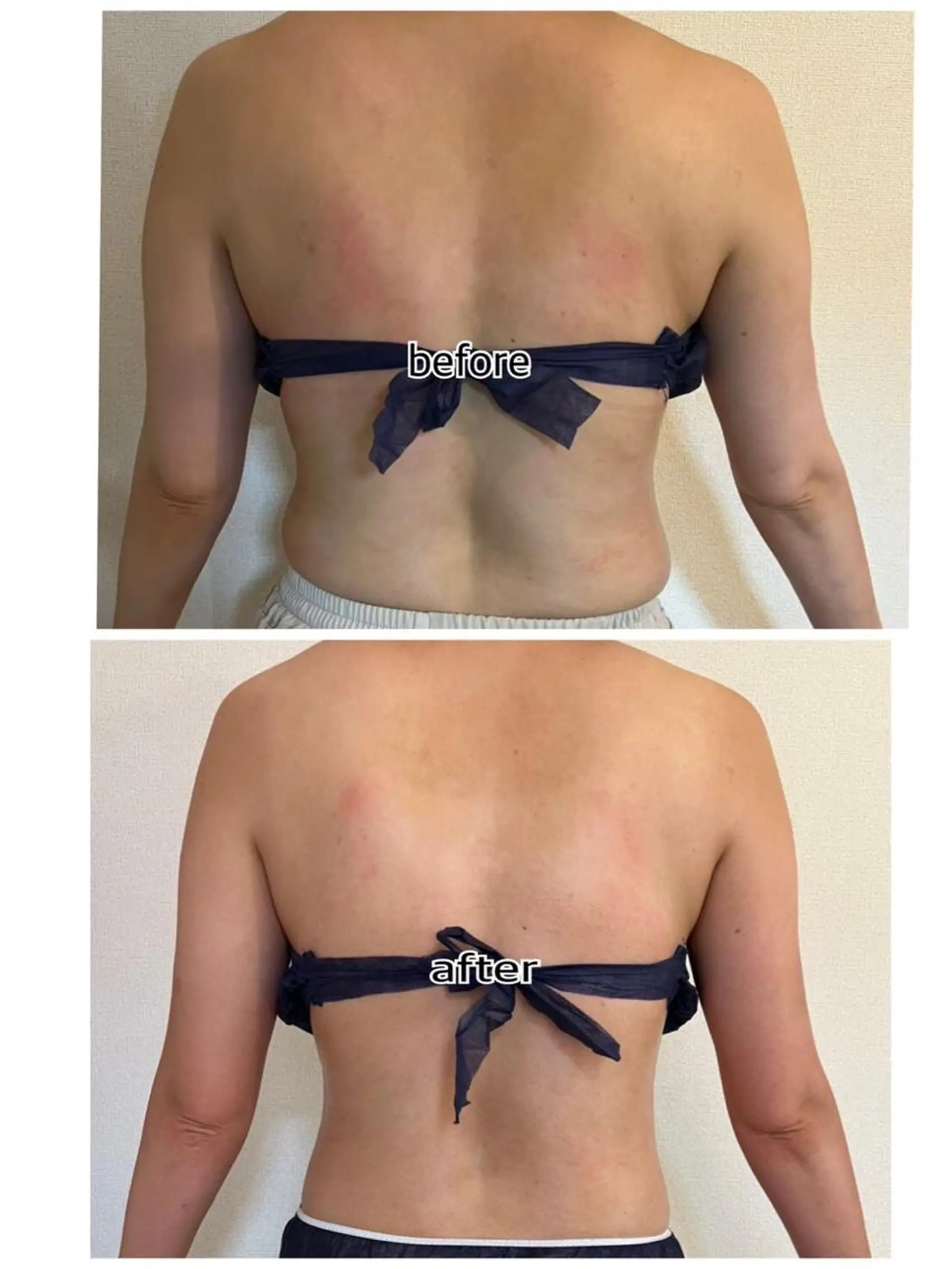 ❤︎MN❤︎ モンのエステ・リラクイメージ