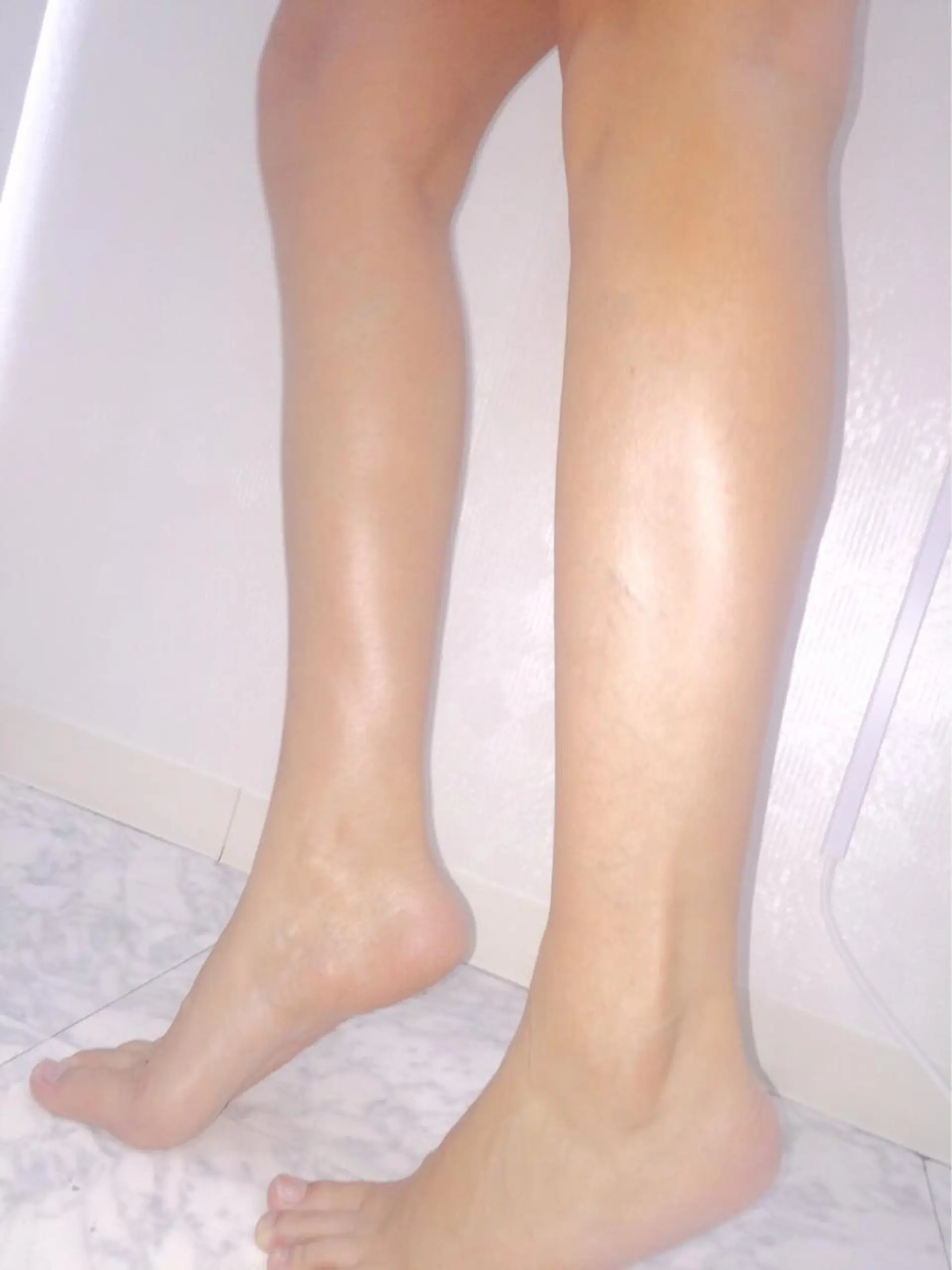 毛穴改善/脱毛 ネイル　川上久仁子のエステ・リラクイメージ