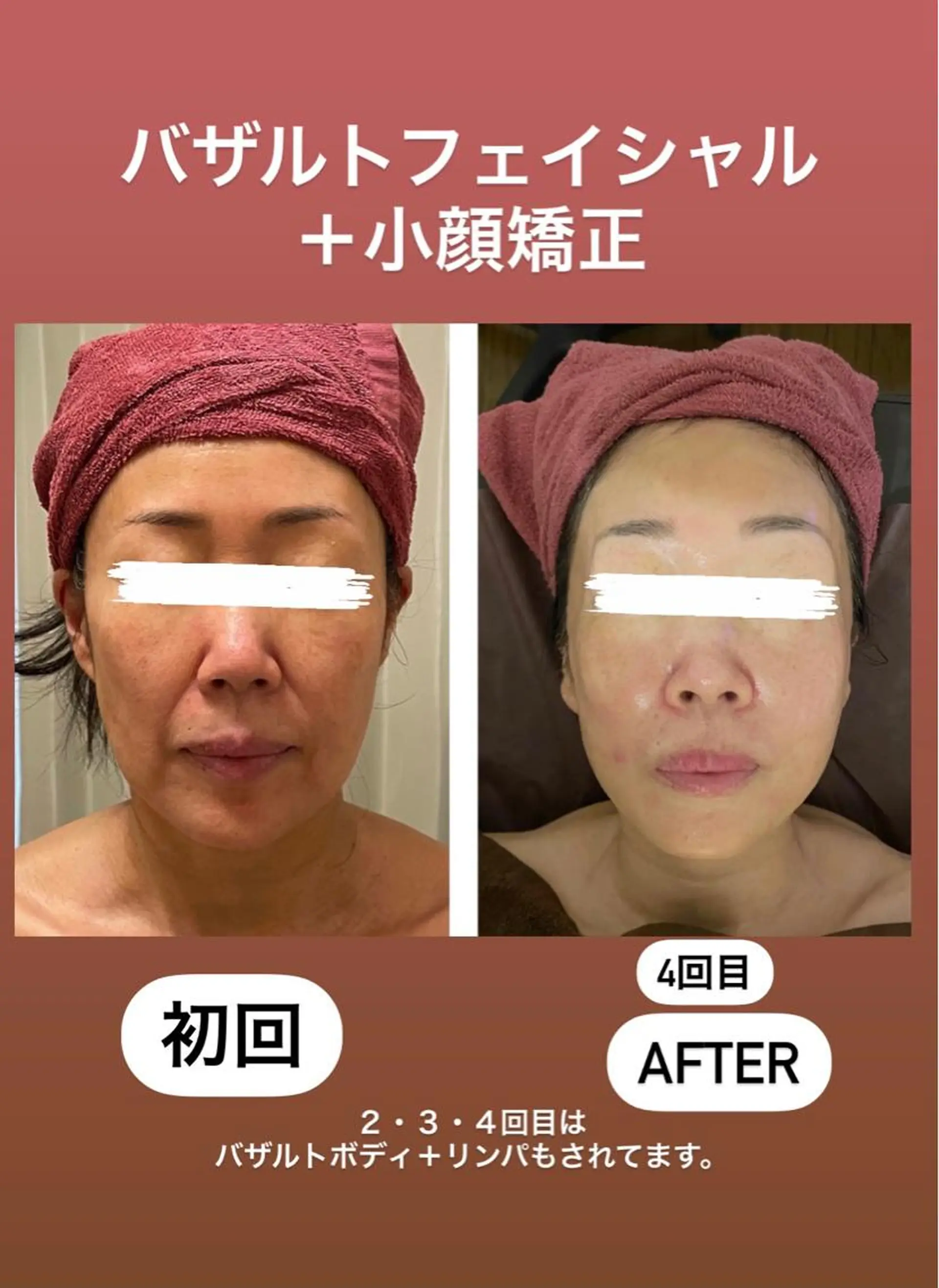 エステ 35歳からの エイジングケアサロンのエステ・リラクイメージ