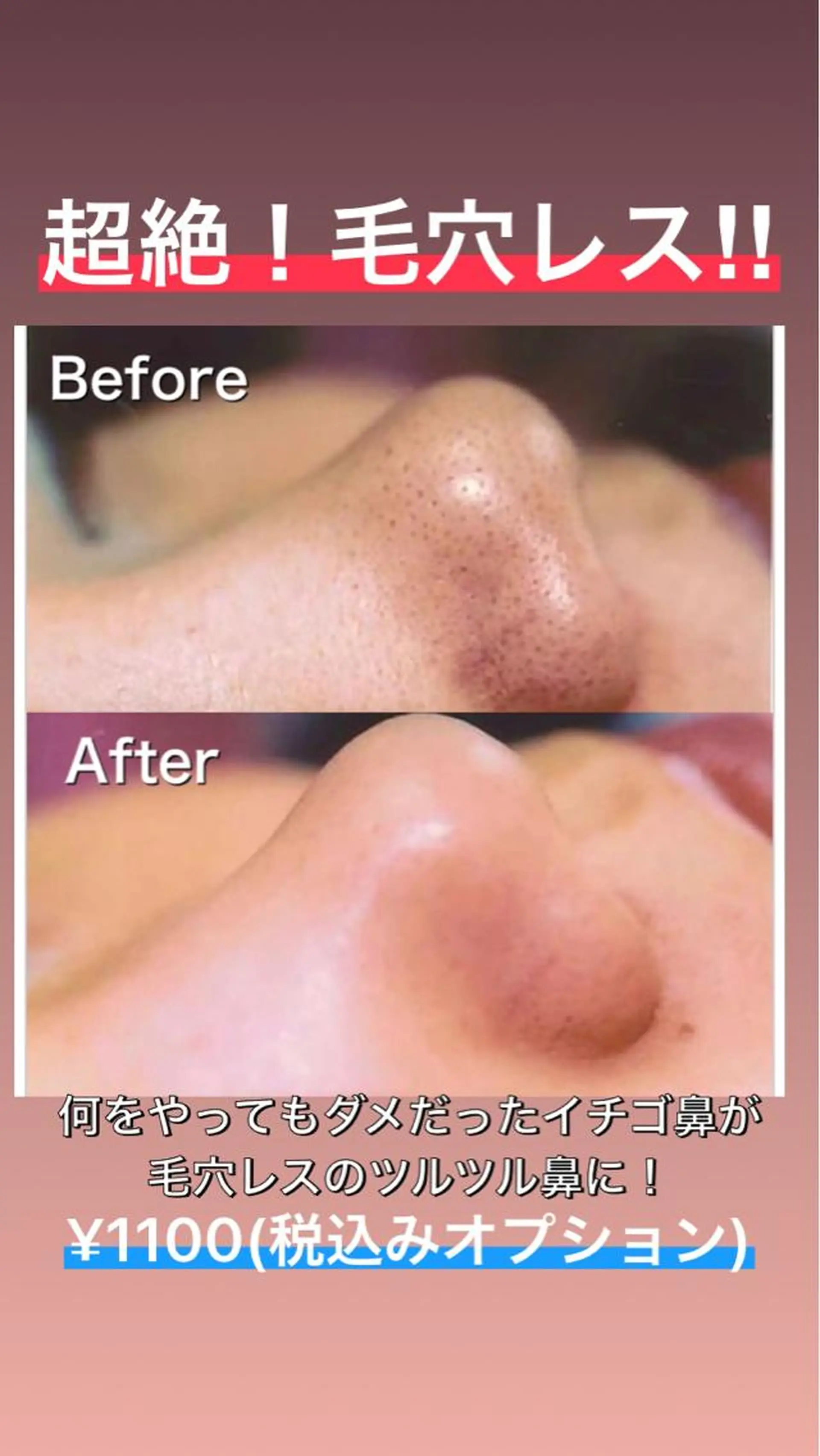 UN・MULAN (大田　瑶子)のエステ・リラクイメージ