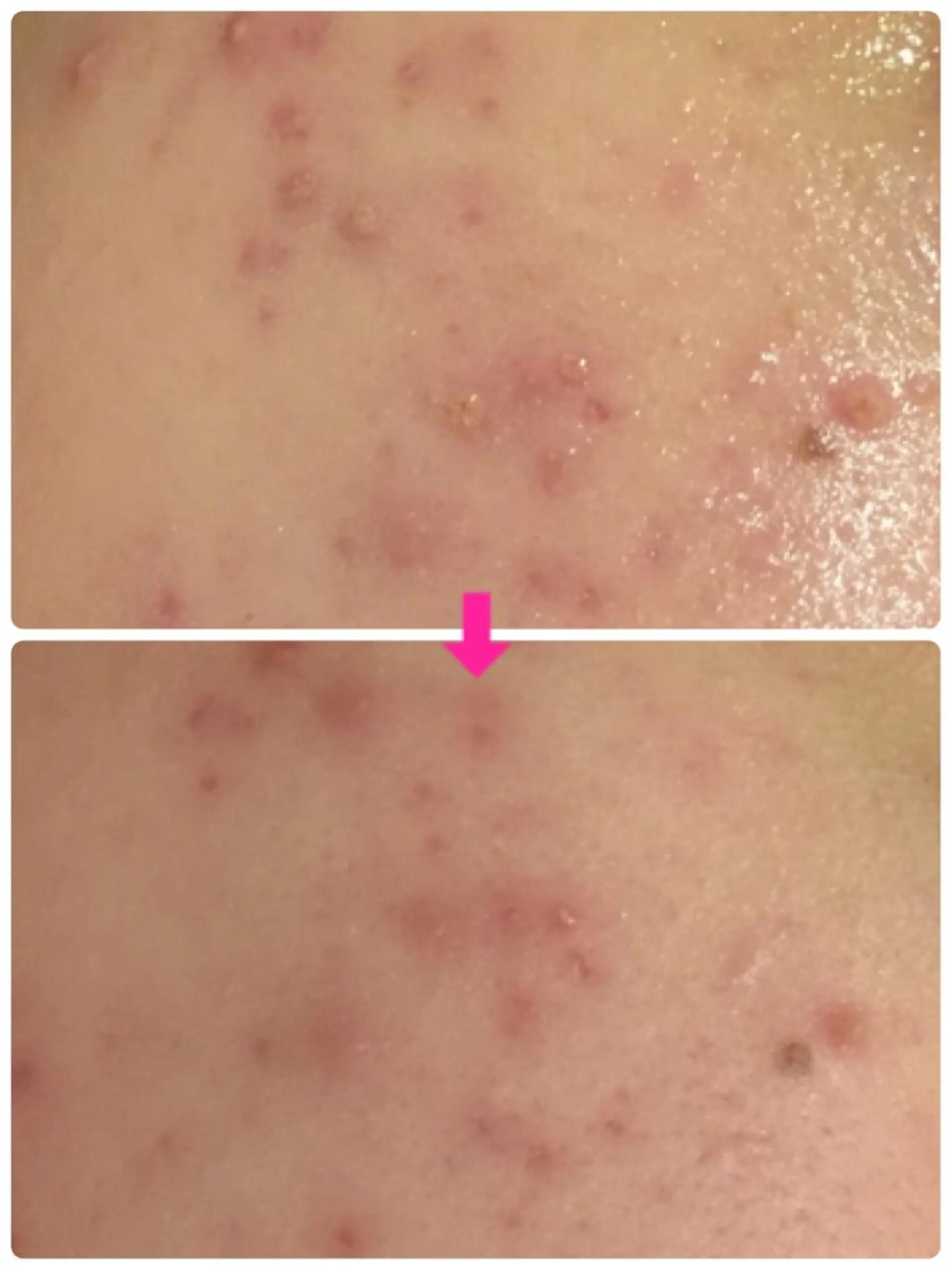 ショート カラー パーマ ヘアアレンジ メンズ キッズ ネイル マツエク・マツパ ‍痩身＆ボディ 結果出し🌟丹野のエステ・リラクイメージ