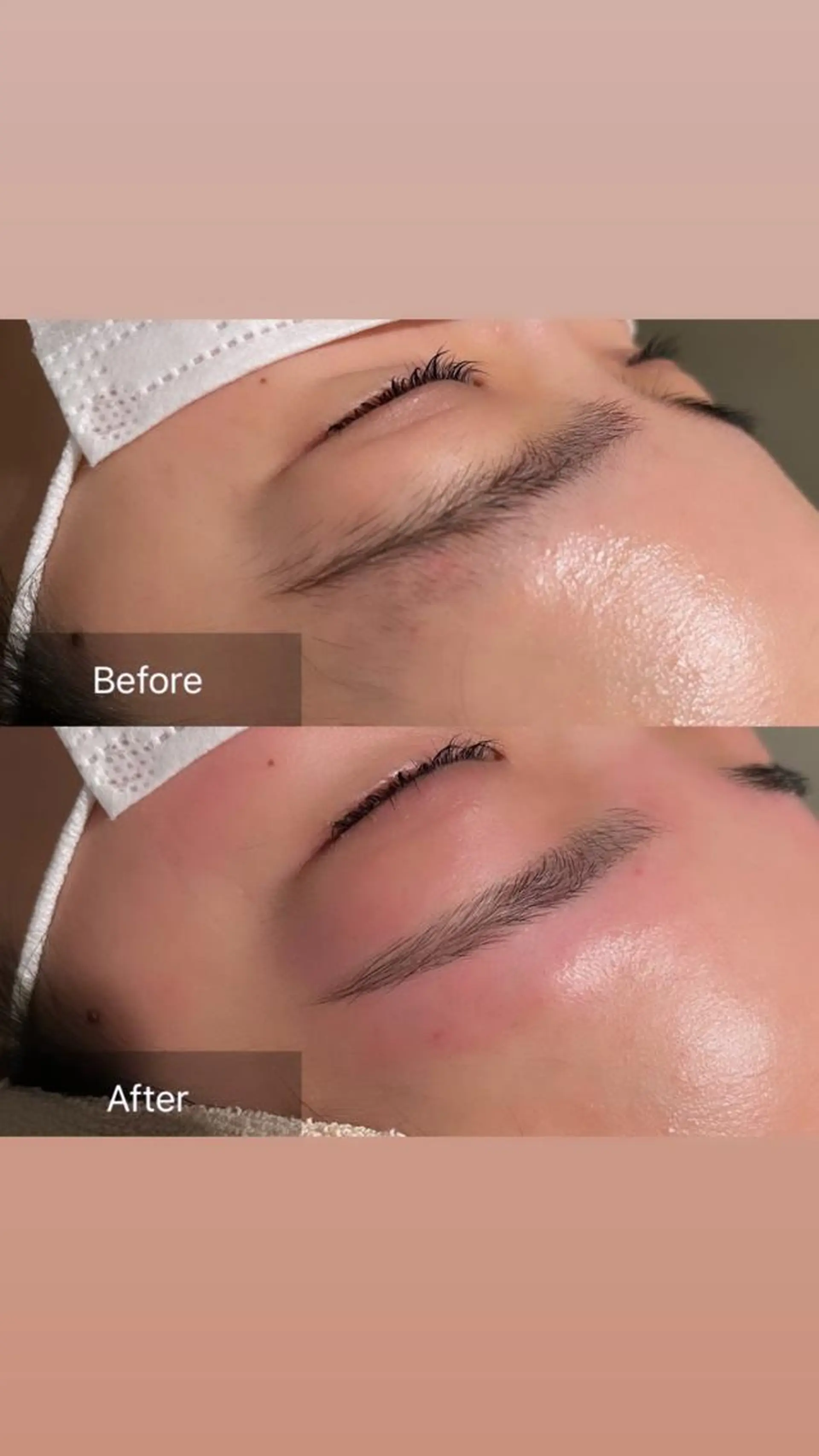 アイブロウ 眉毛ワックス脱毛 for woman所属・森 美優のエステ・リラクイメージ