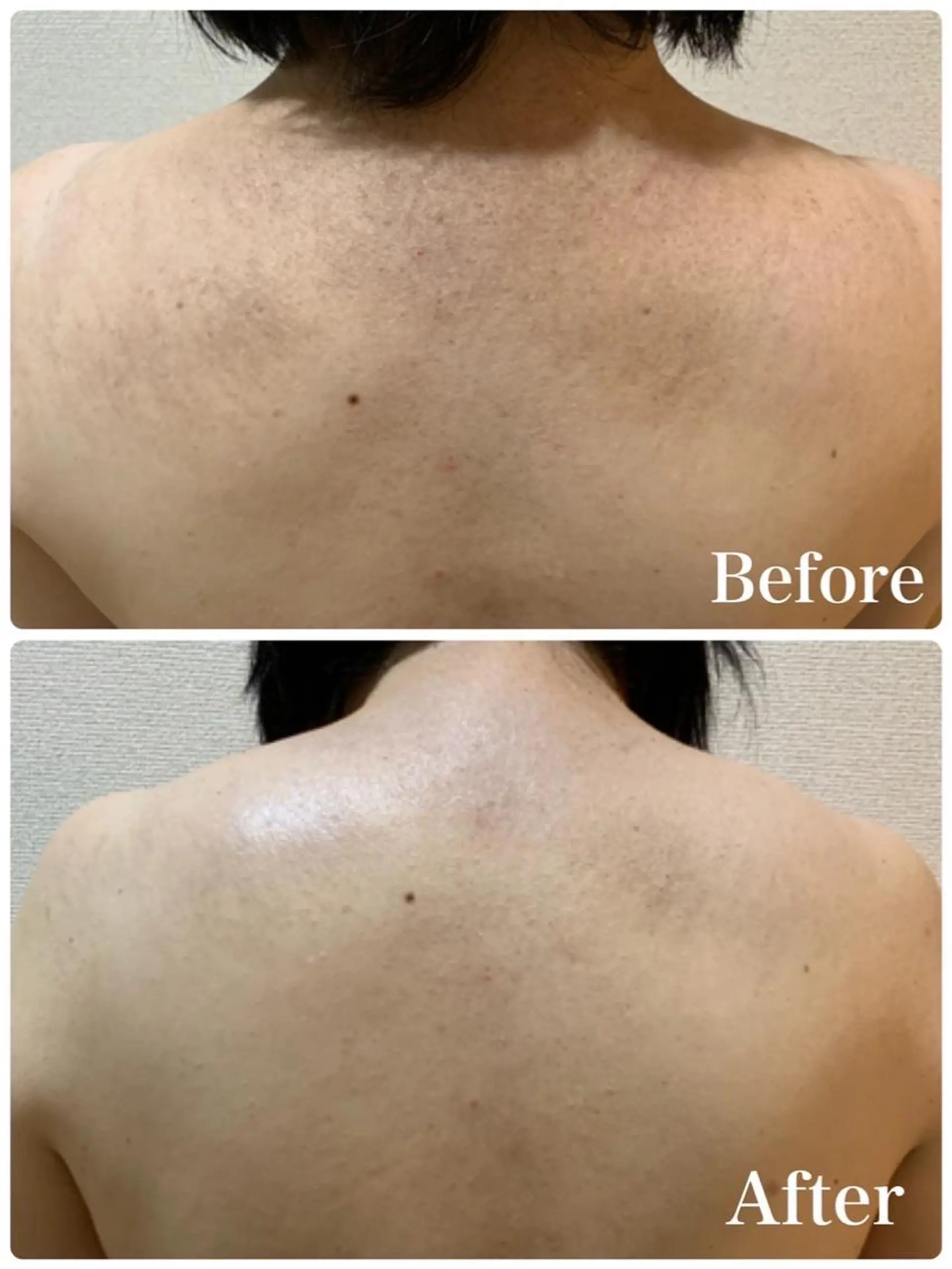 Lumiere despoirのエステ・リラクイメージ