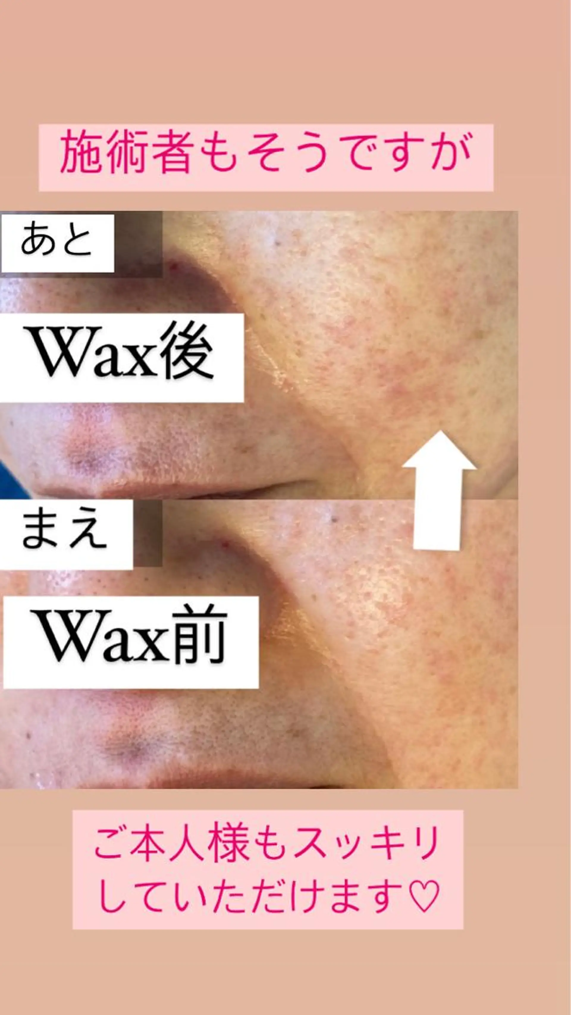 脱毛 産毛専門店 Bittoのエステ・リラクイメージ