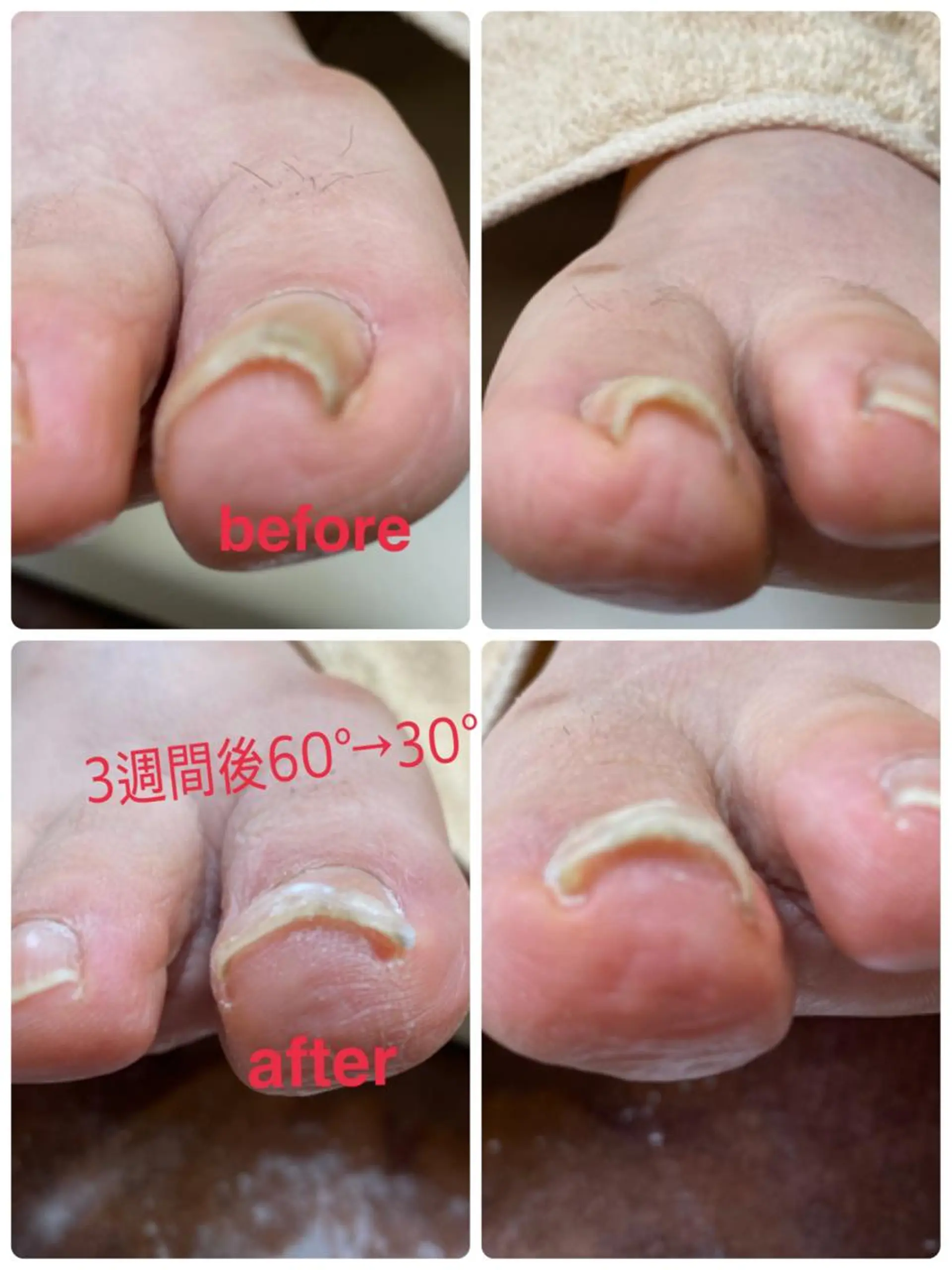 ネイル 巻き爪&フットケア レクーラのその他イメージ