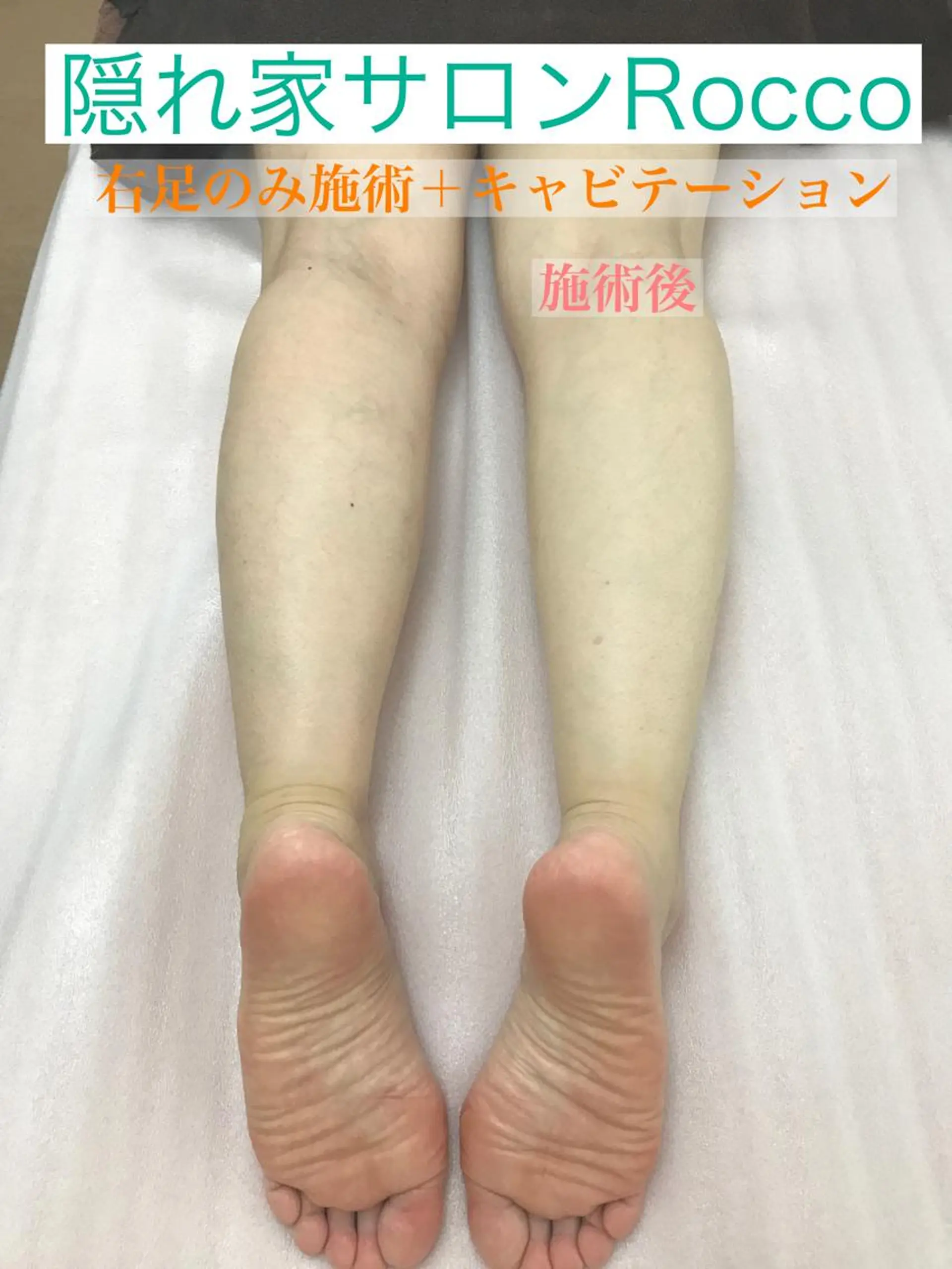 隠れ家サロン Roccoのエステ・リラクイメージ