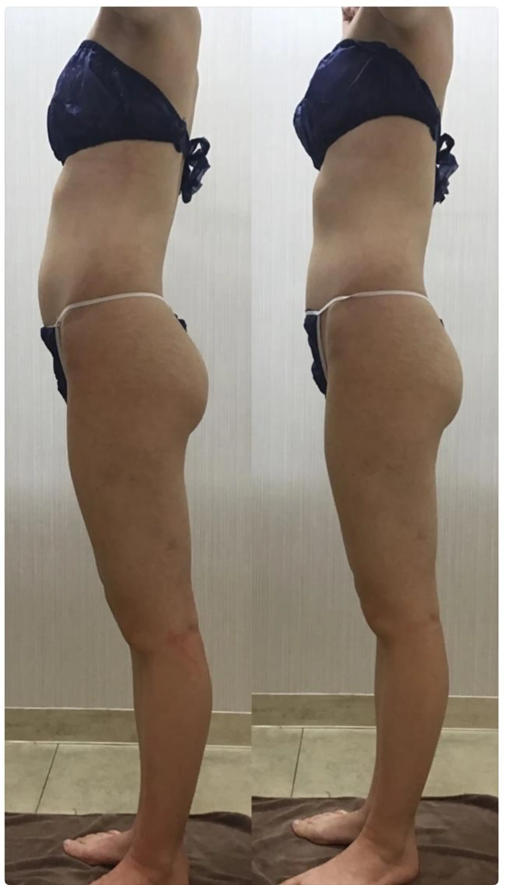 エステ リラク ♡美バスト美姿勢♡ 池袋TUKADA☆のエステ・リラクイメージ