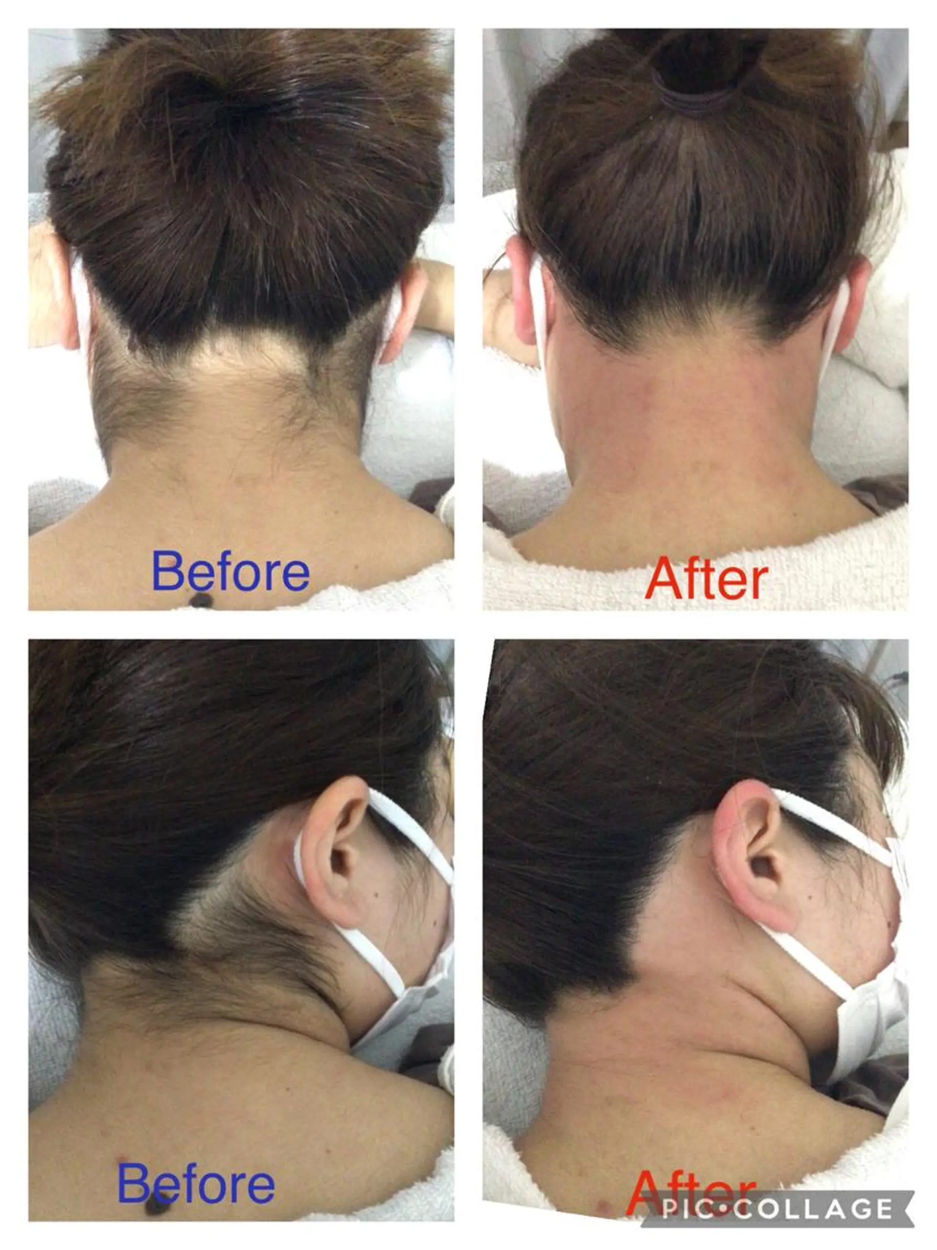 脱毛 子宮矯正/腸揉み/ シュガーリング脱毛のエステ・リラクイメージ