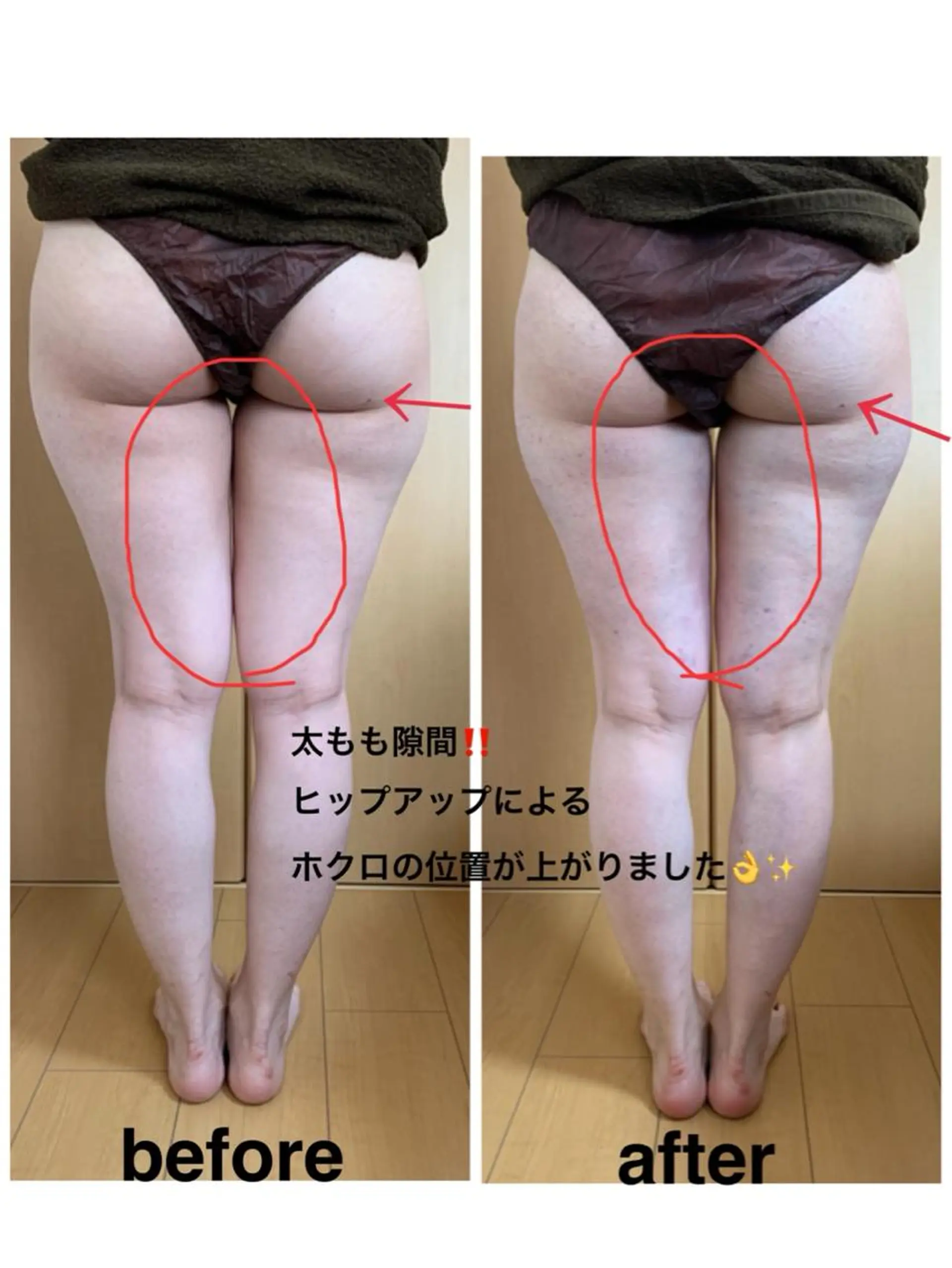 痩身/脱毛/ネイル HARUKAのエステ・リラクイメージ