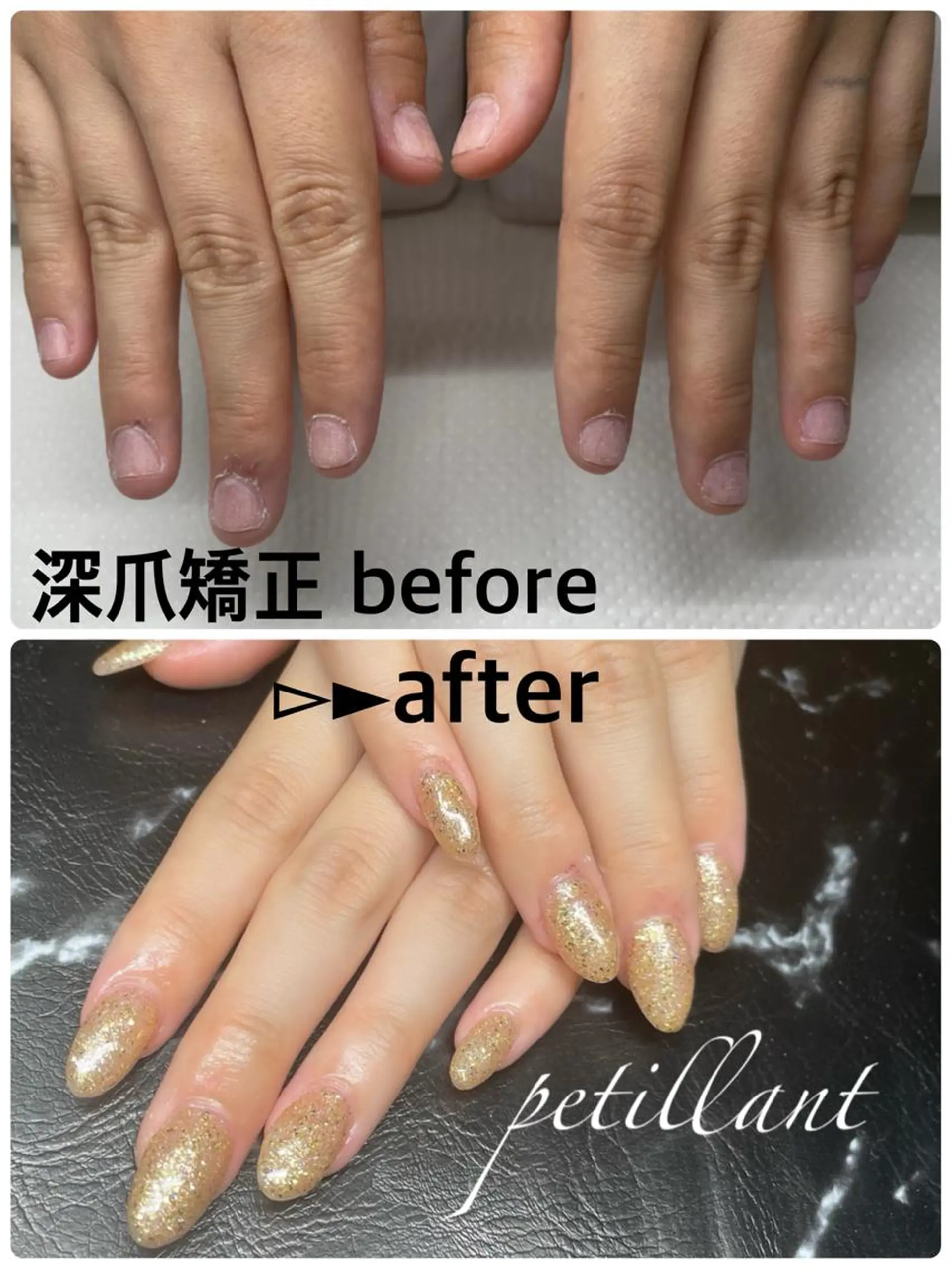 ネイル キラキラネイル ラメ(グリッター) ハンドネイル ハンドケア nail salon petillantのネイルデザイン