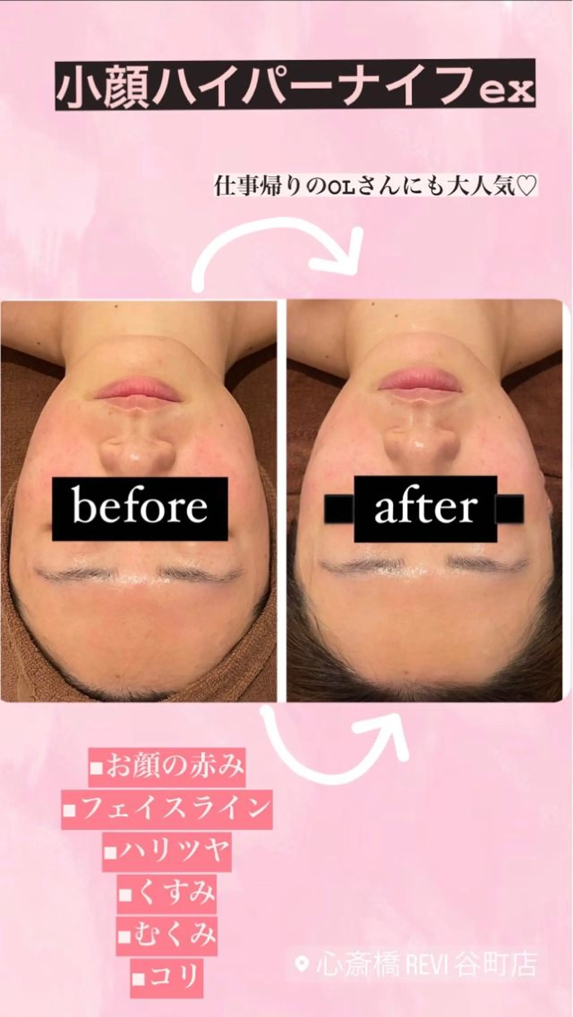 エステ トラブル肌改善🏥 Meow！🫧🫧のエステ・リラクイメージ