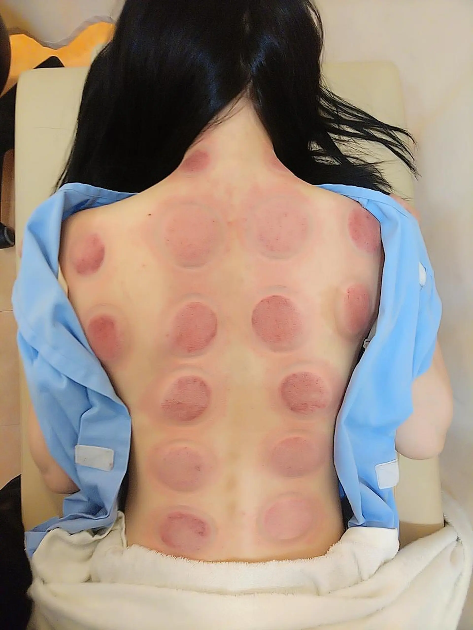 お顔のむくみたるみ 専門☆美容鍼小顔矯正のエステ・リラクイメージ