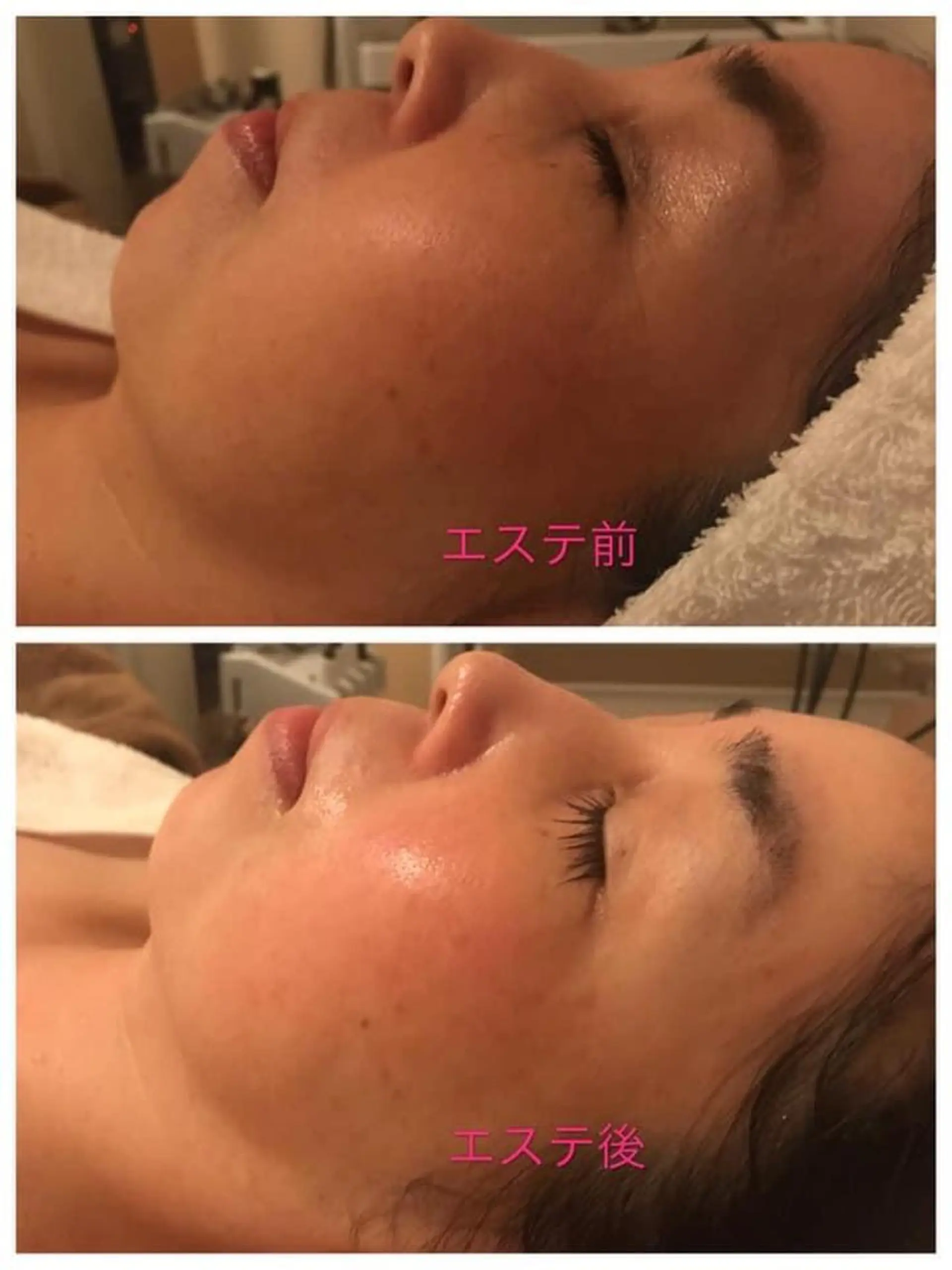 エステ エステサロン endearのエステ・リラクイメージ