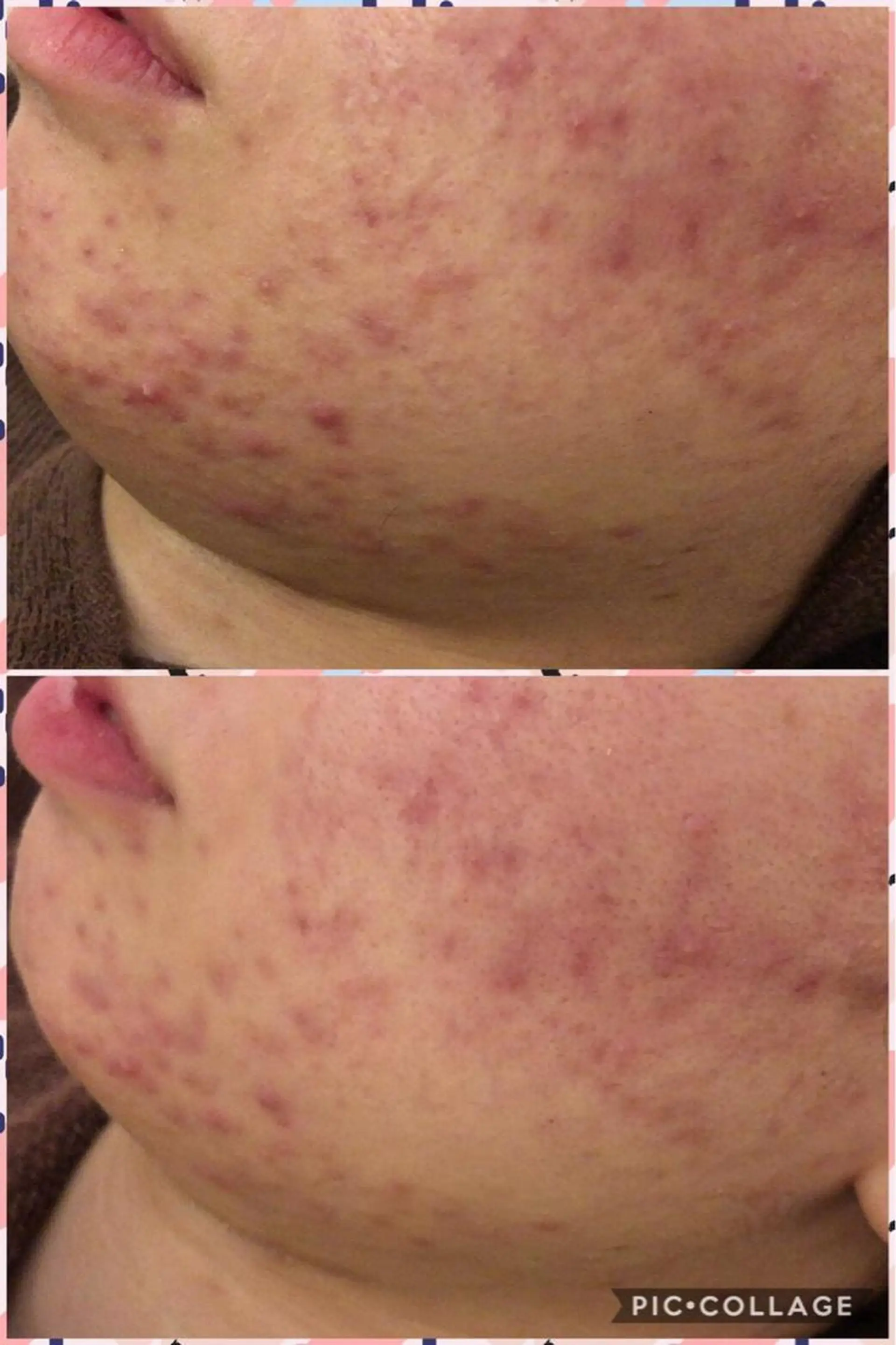 メンズ 金の糸脱毛 産毛ケア専門のエステ・リラクイメージ