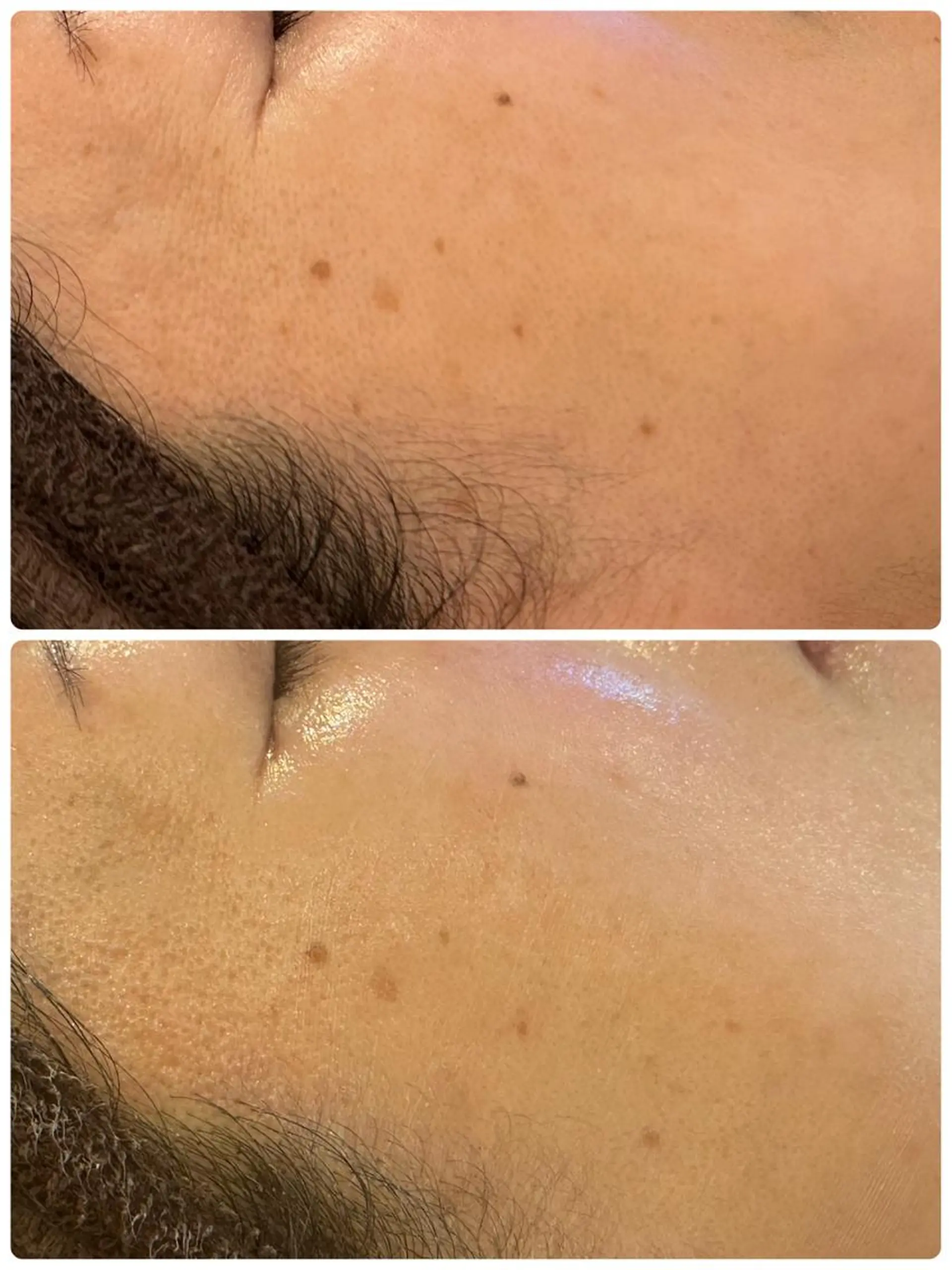 エステ LILY E所属・LILY Eのエステ・リラクイメージ