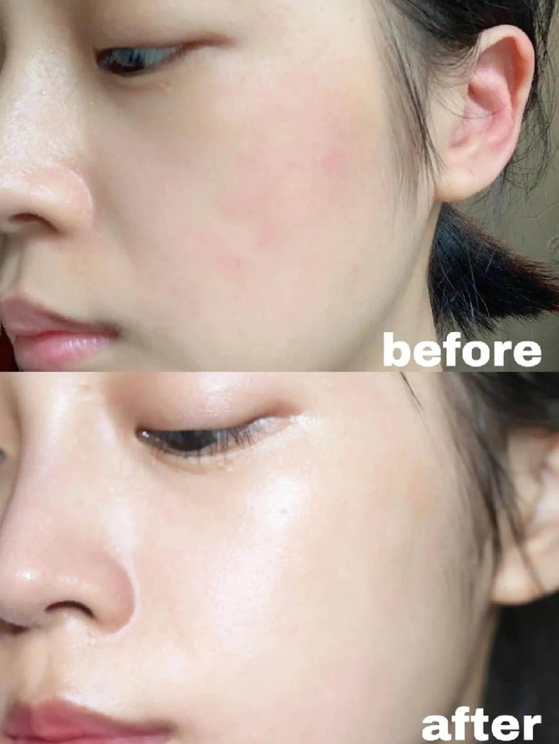 脱毛 aliaハーブ水光店 エステティシャン募集のエステ・リラクイメージ