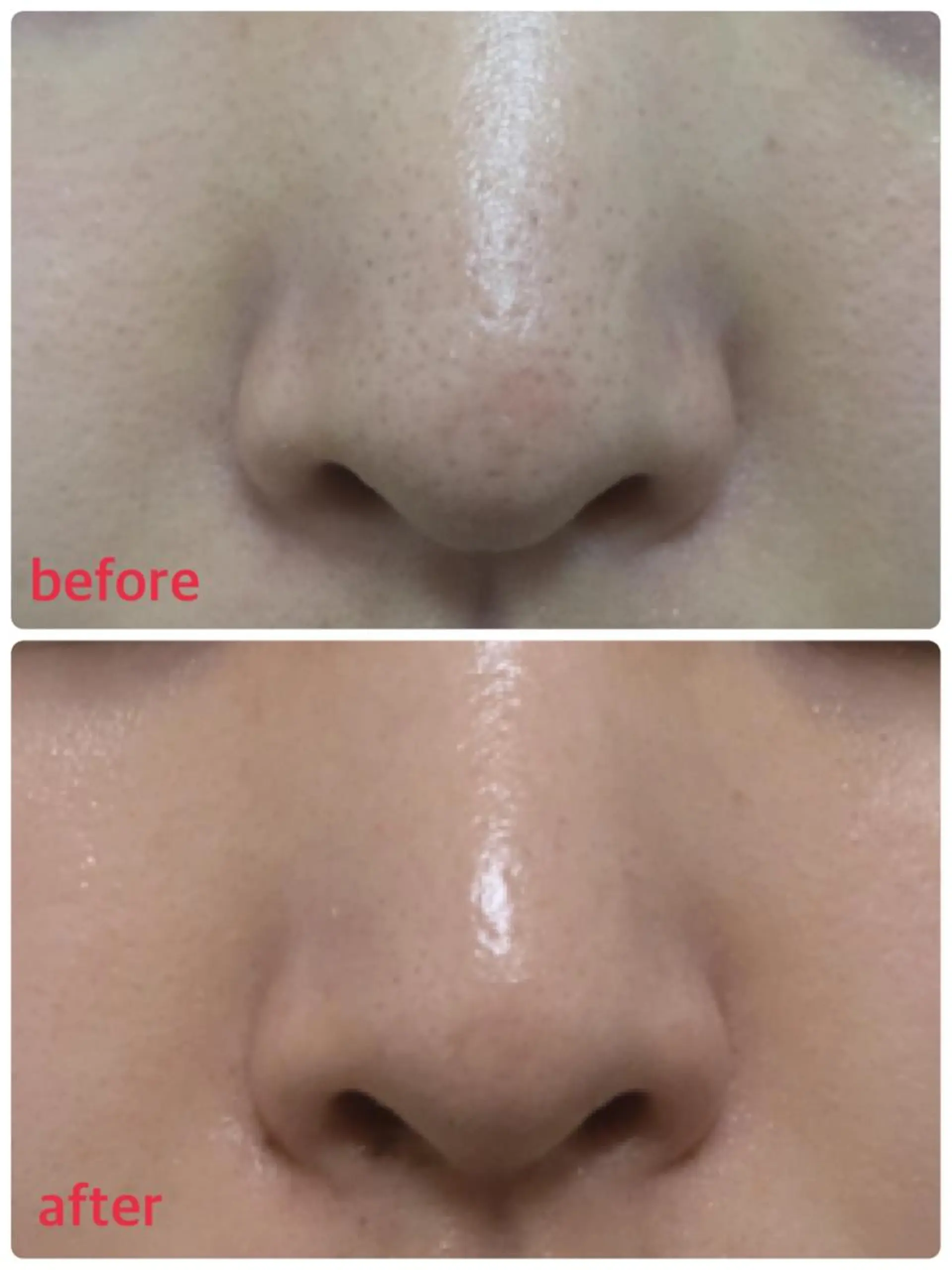 美SORA ～ｳﾞｨｿﾗ～のネイルデザイン