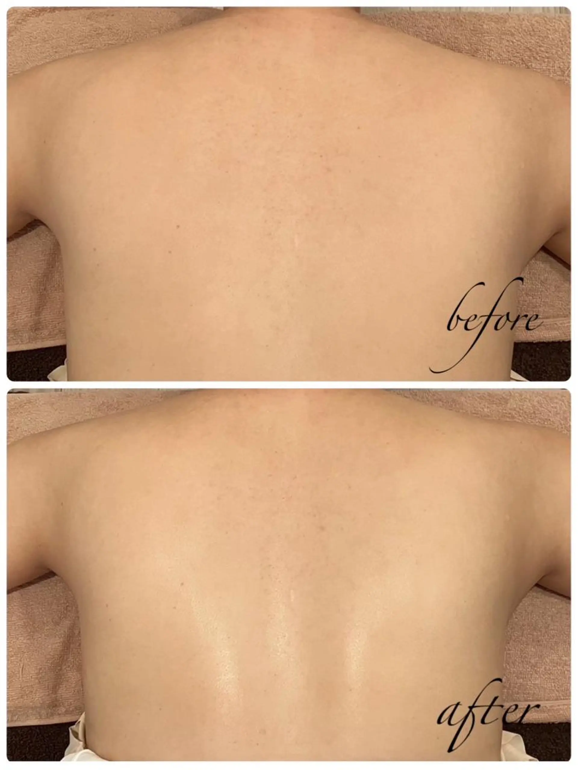 エステ トータルビューティー サロンキノセ折井のエステ・リラクイメージ