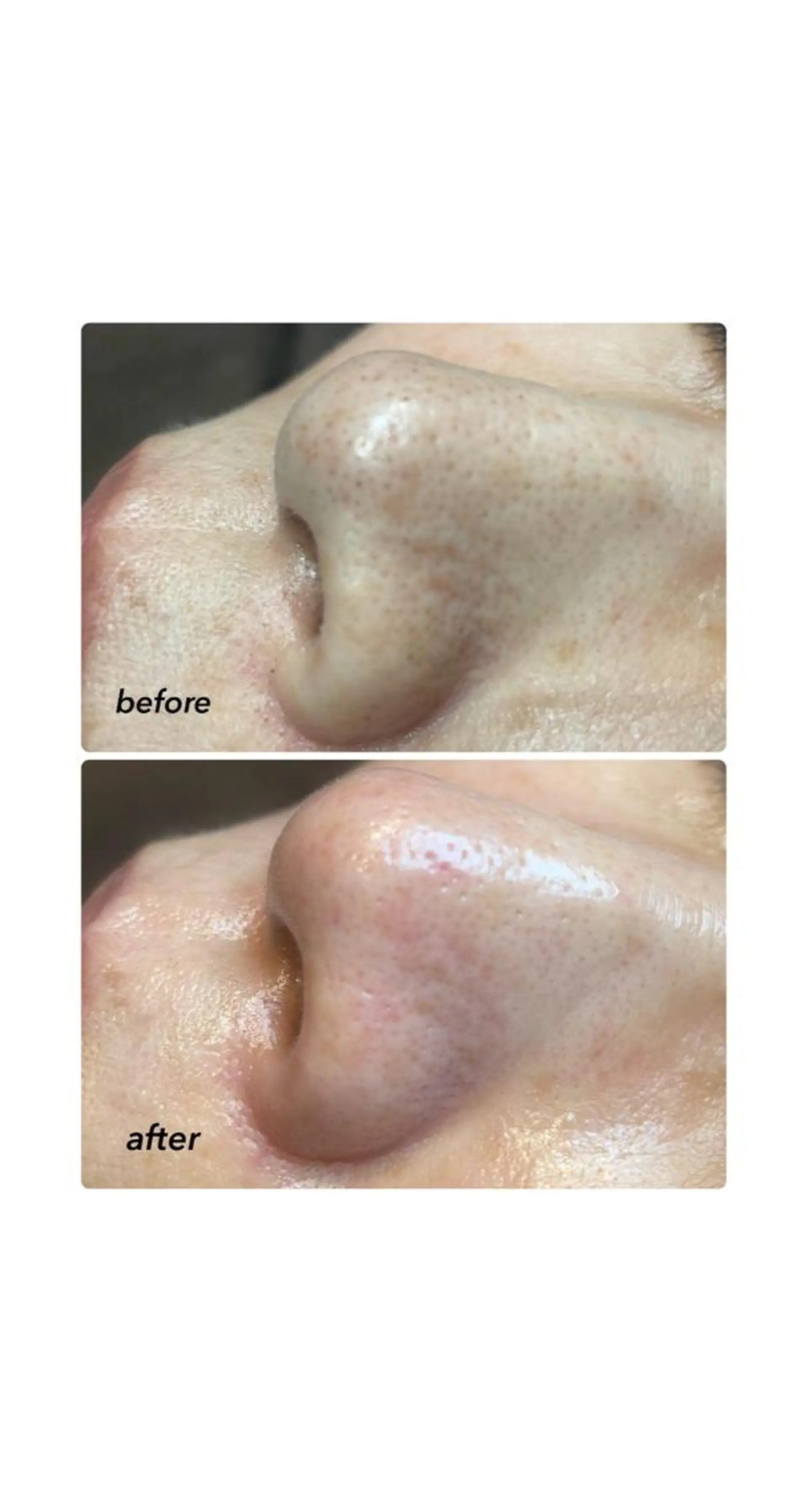 松下 千恵のネイルデザイン