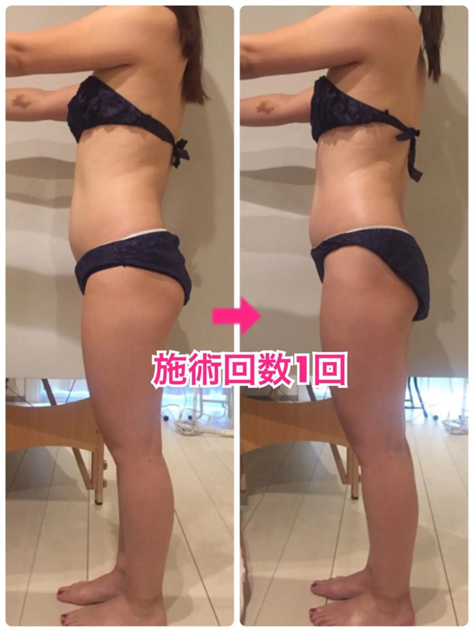 ロング カラー パーマ ヘアアレンジ メンズ キッズ ネイル マツエク・マツパ ‍痩身＆ボディ 結果出し🌟丹野のエステ・リラクイメージ