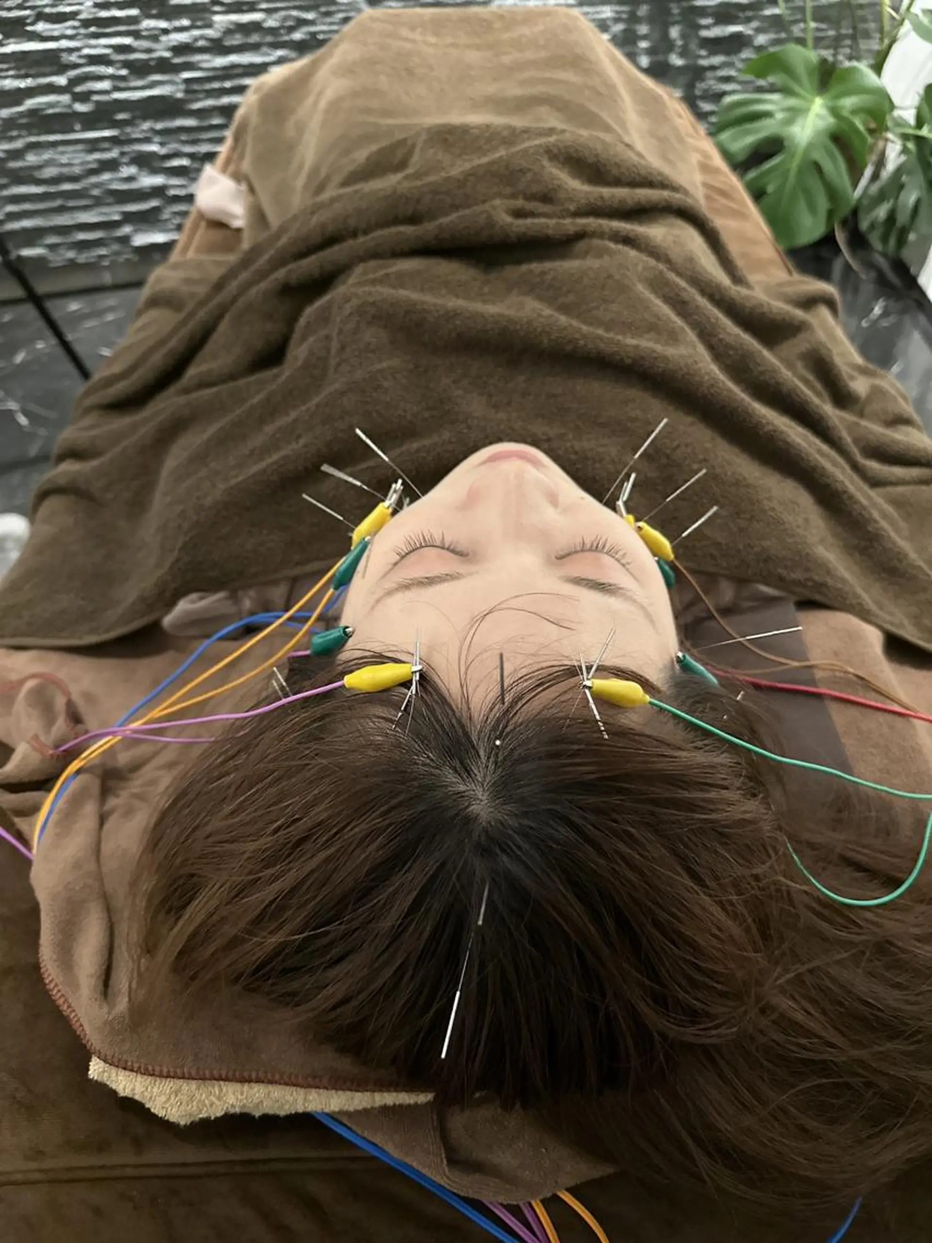 その他 美容鍼灸整体サロンBeauJu所属・小顔矯/美容鍼/鍼灸 BeauJuのその他イメージ