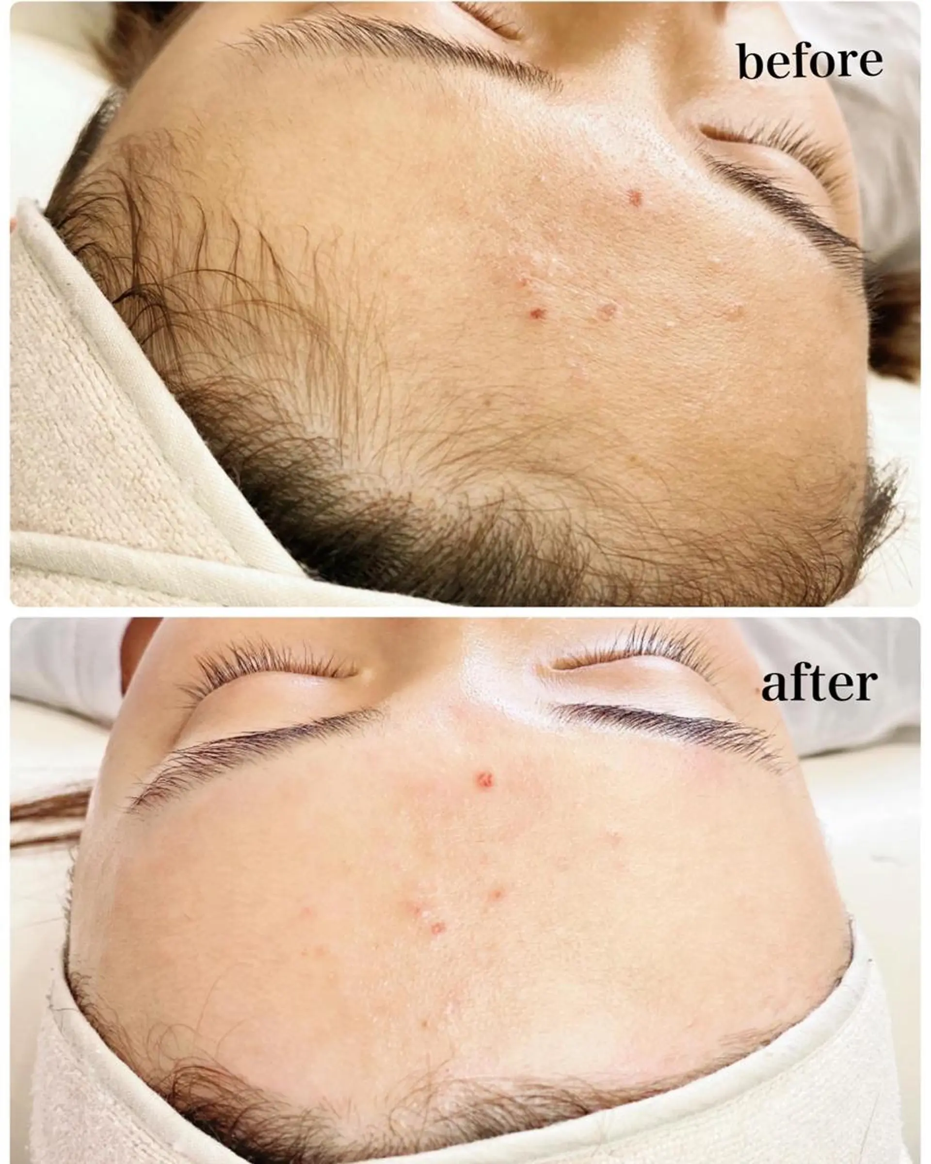 多摩境ViVi chinamiのエステ・リラクイメージ