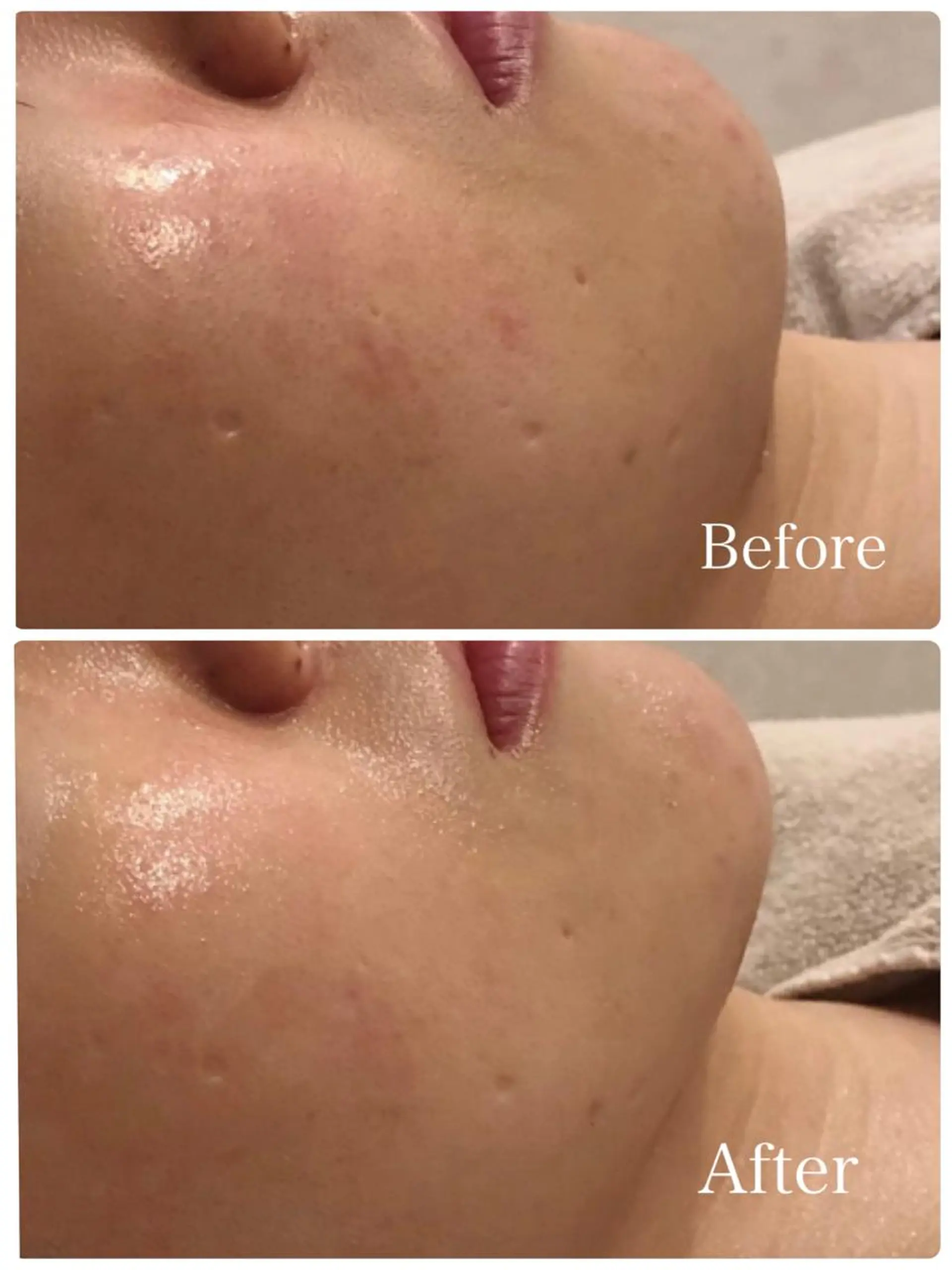 エステ L’Beige レベージュのエステ・リラクイメージ