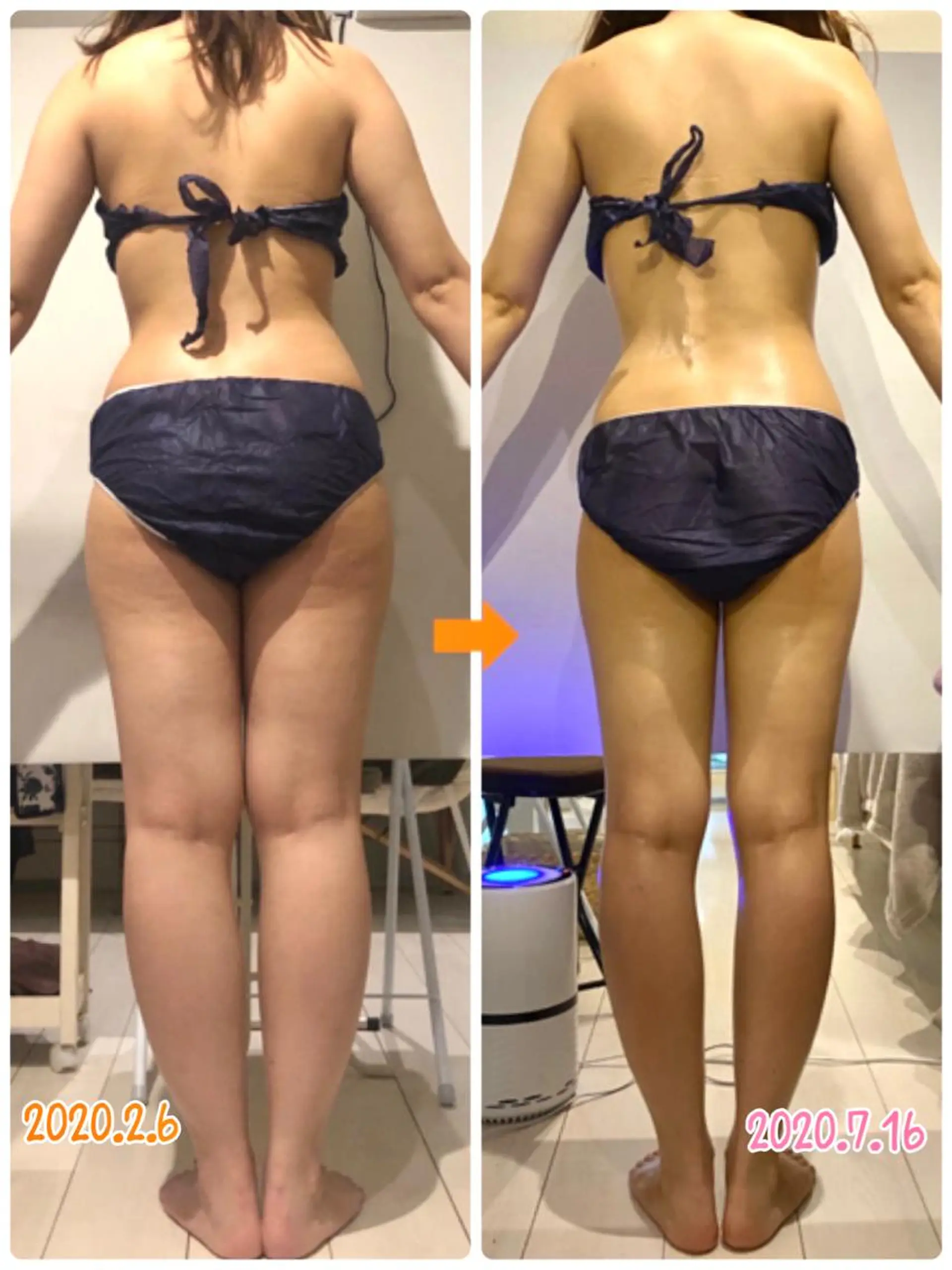 ショート カラー パーマ ヘアアレンジ メンズ キッズ ネイル マツエク・マツパ エステ リラク ‍痩身＆ボディ 結果出し🌟丹野のエステ・リラクイメージ