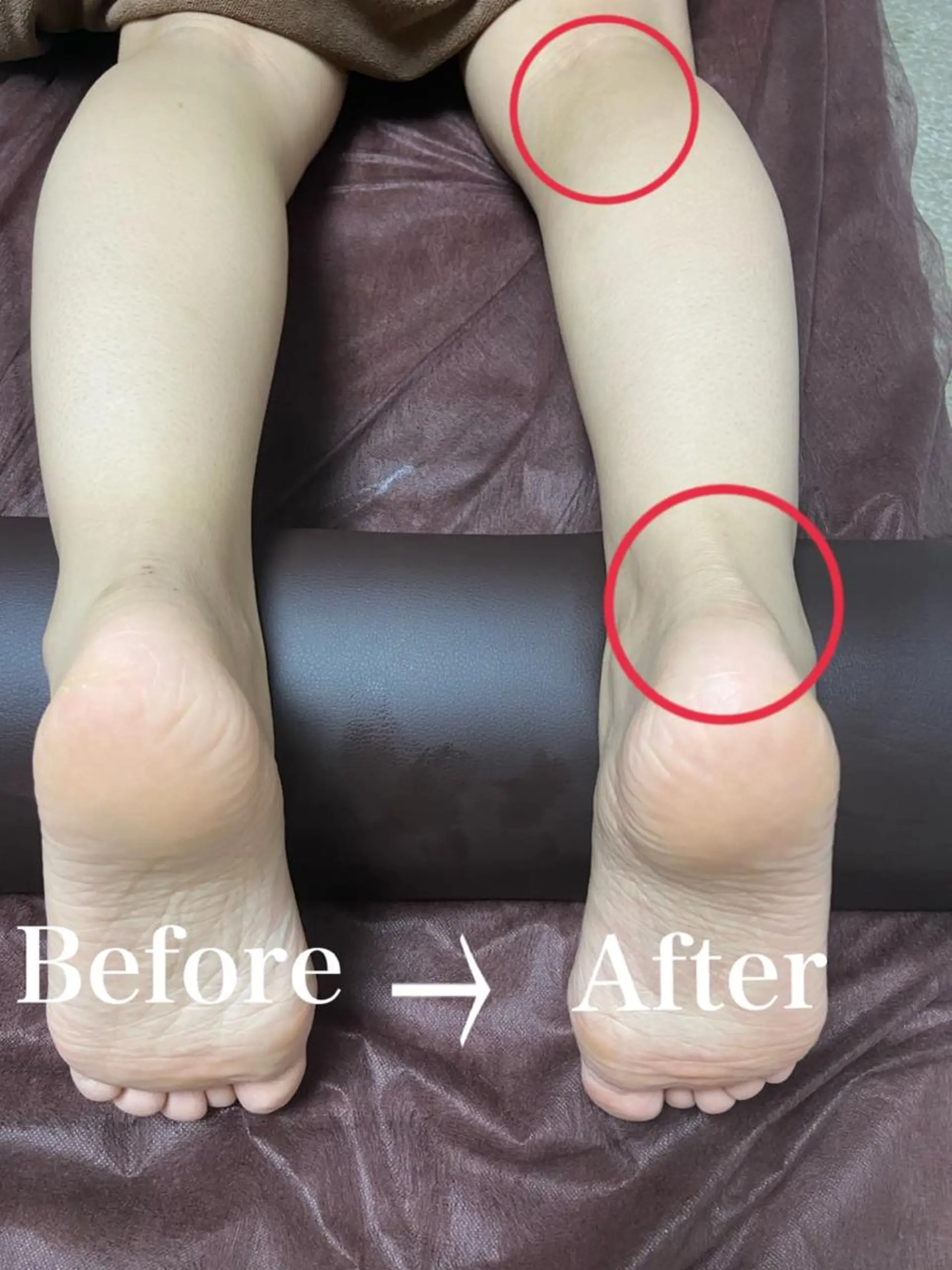 エステ リラク Plumeria (プルメリア)川口のエステ・リラクイメージ