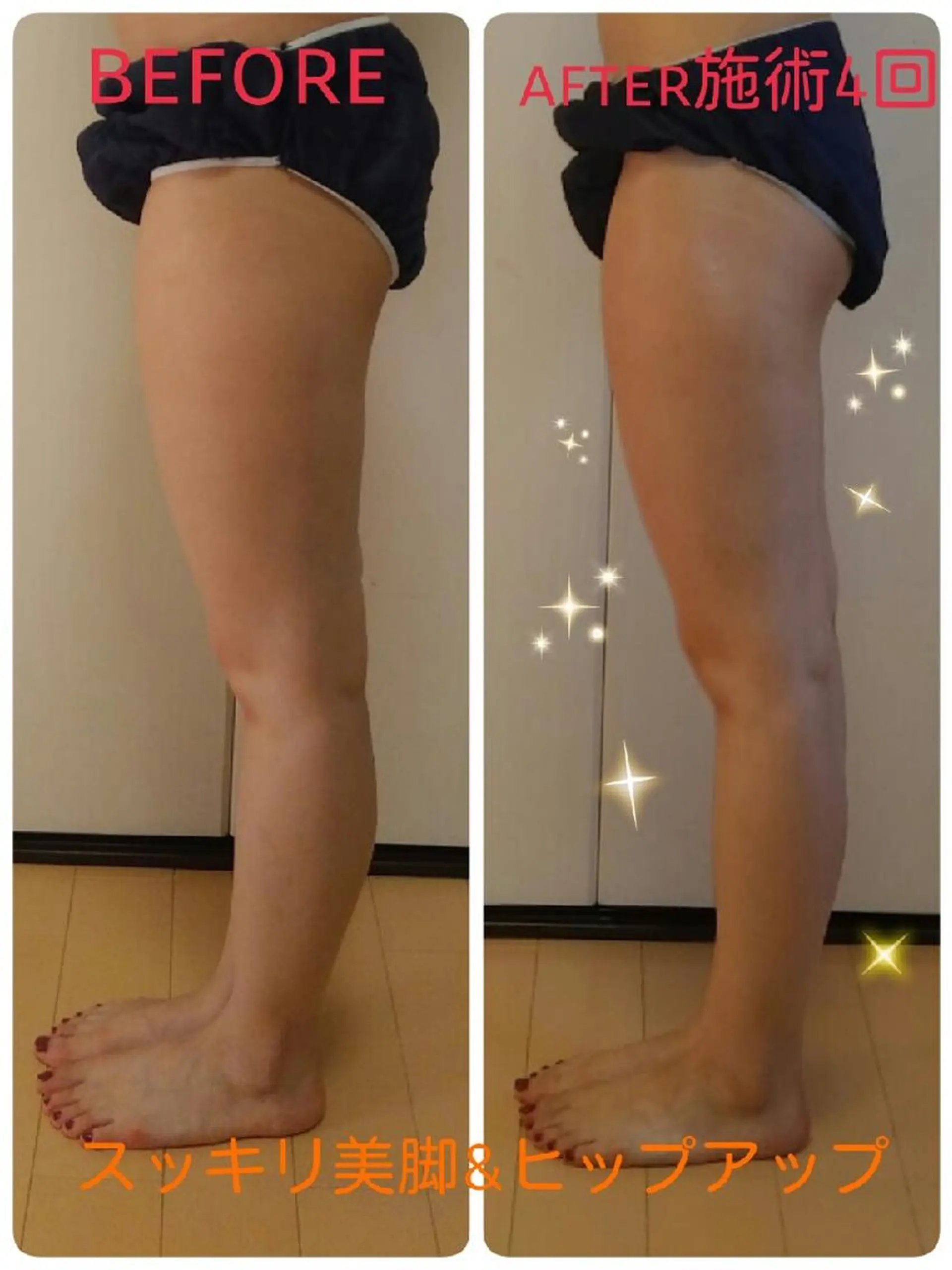 リンパサロン レディ ワンのエステ・リラクイメージ