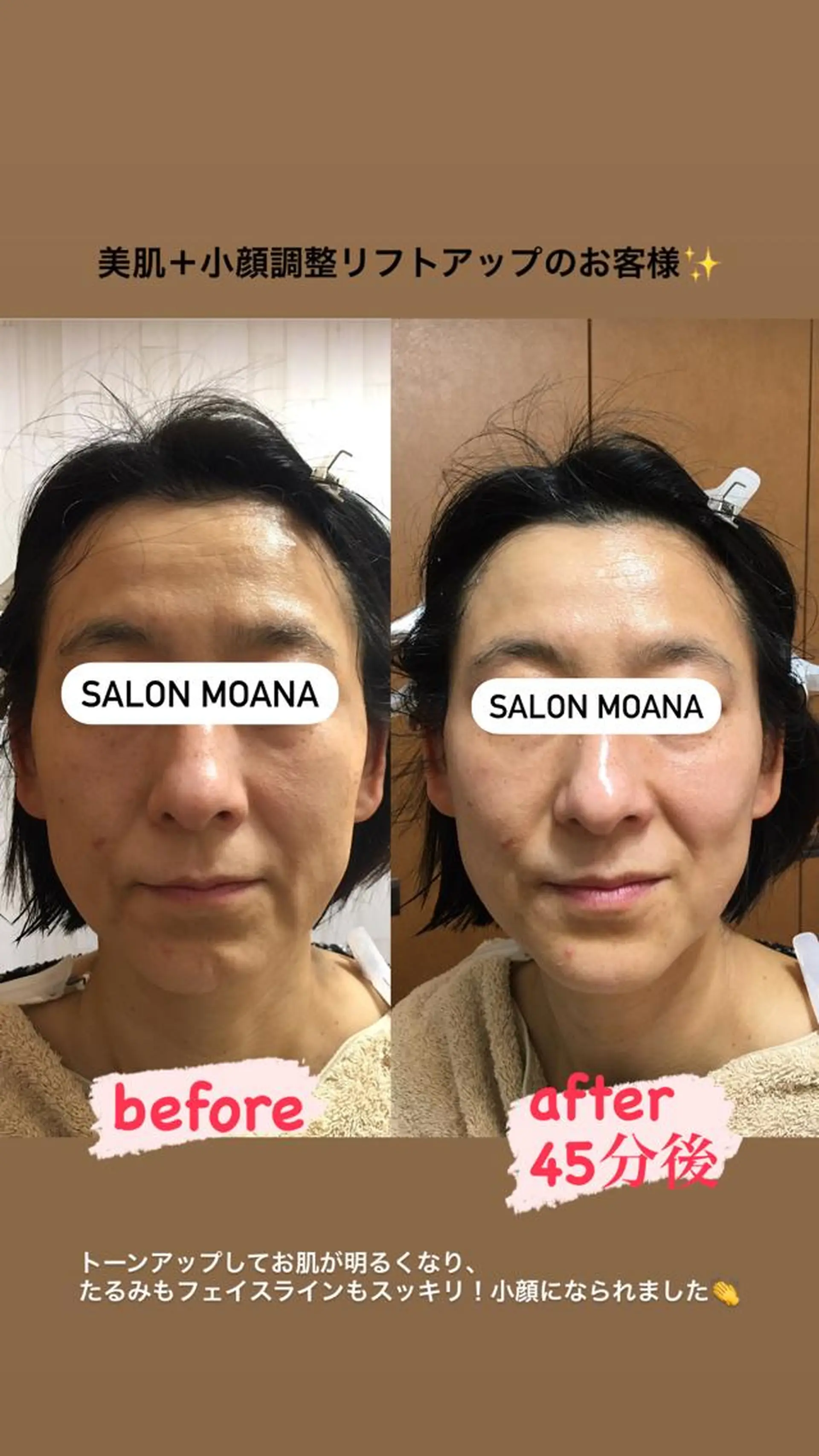 小顔美肌salon MOANAのエステ・リラクイメージ