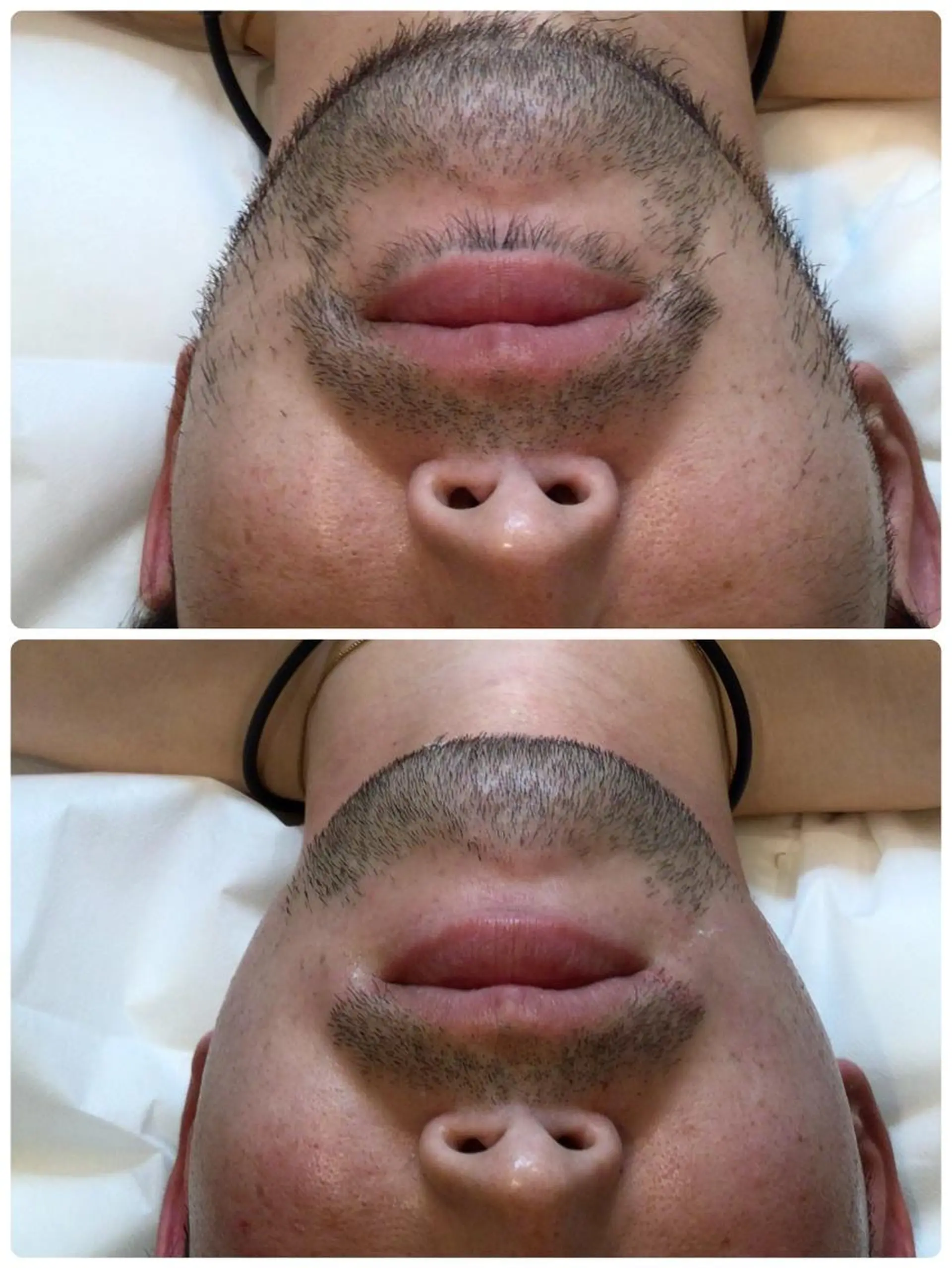 メンズ 脱毛 Mei シュガーリストのエステ・リラクイメージ