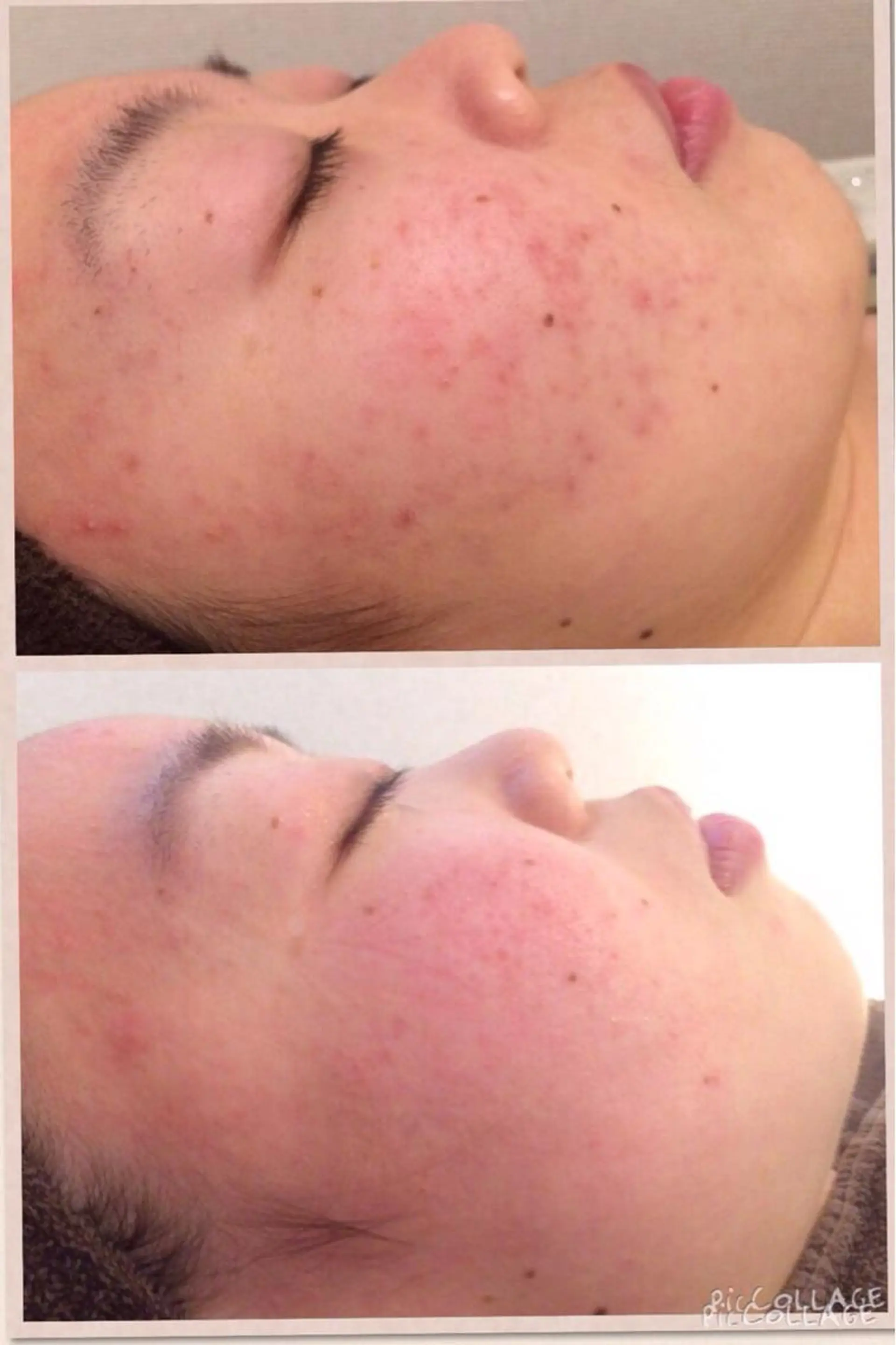 アニメ,Vオタク× 即効痩せエステサロンのエステ・リラクイメージ