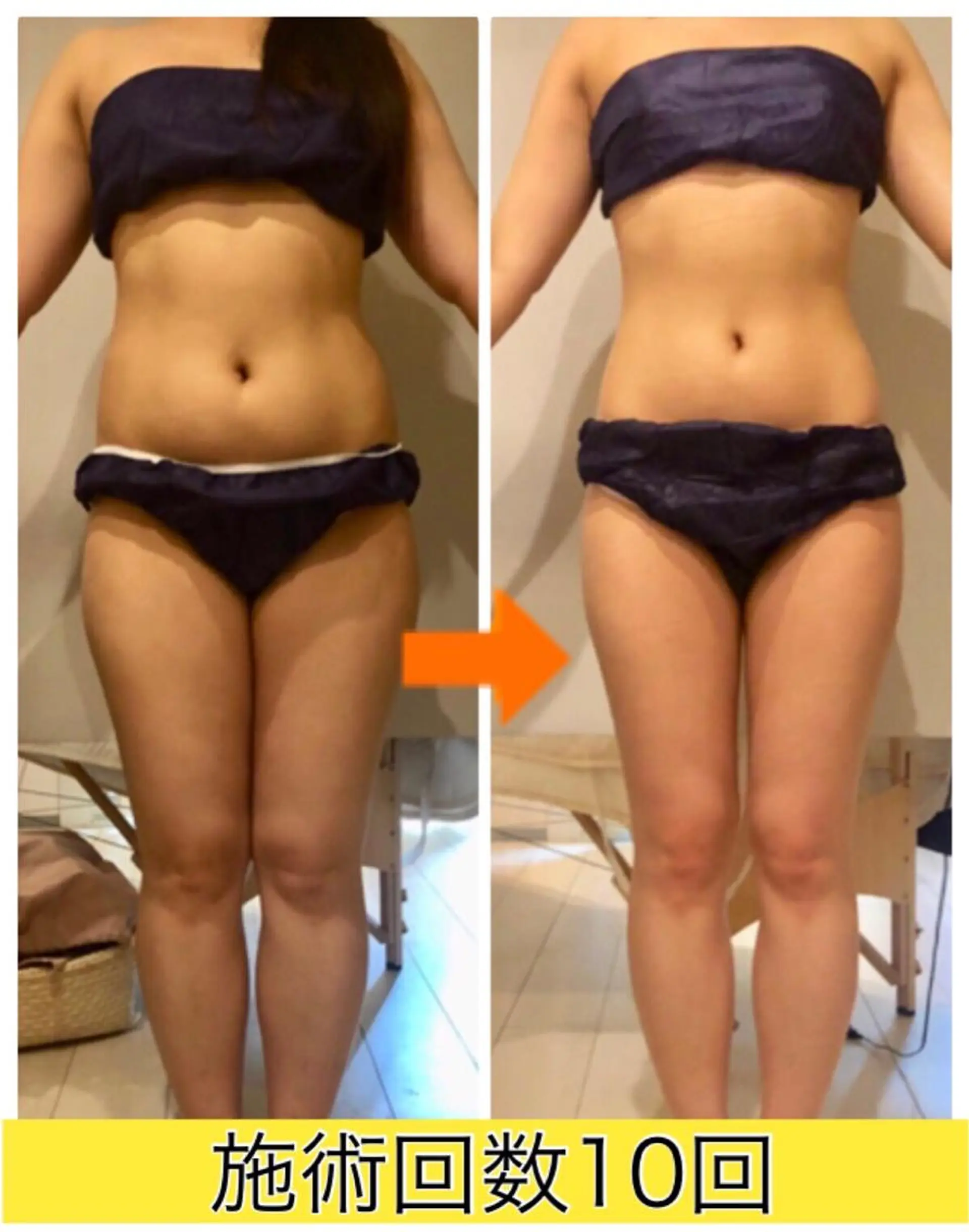 ロング カラー パーマ ヘアアレンジ メンズ キッズ ネイル マツエク・マツパ ‍痩身＆ボディ 結果出し🌟丹野のエステ・リラクイメージ