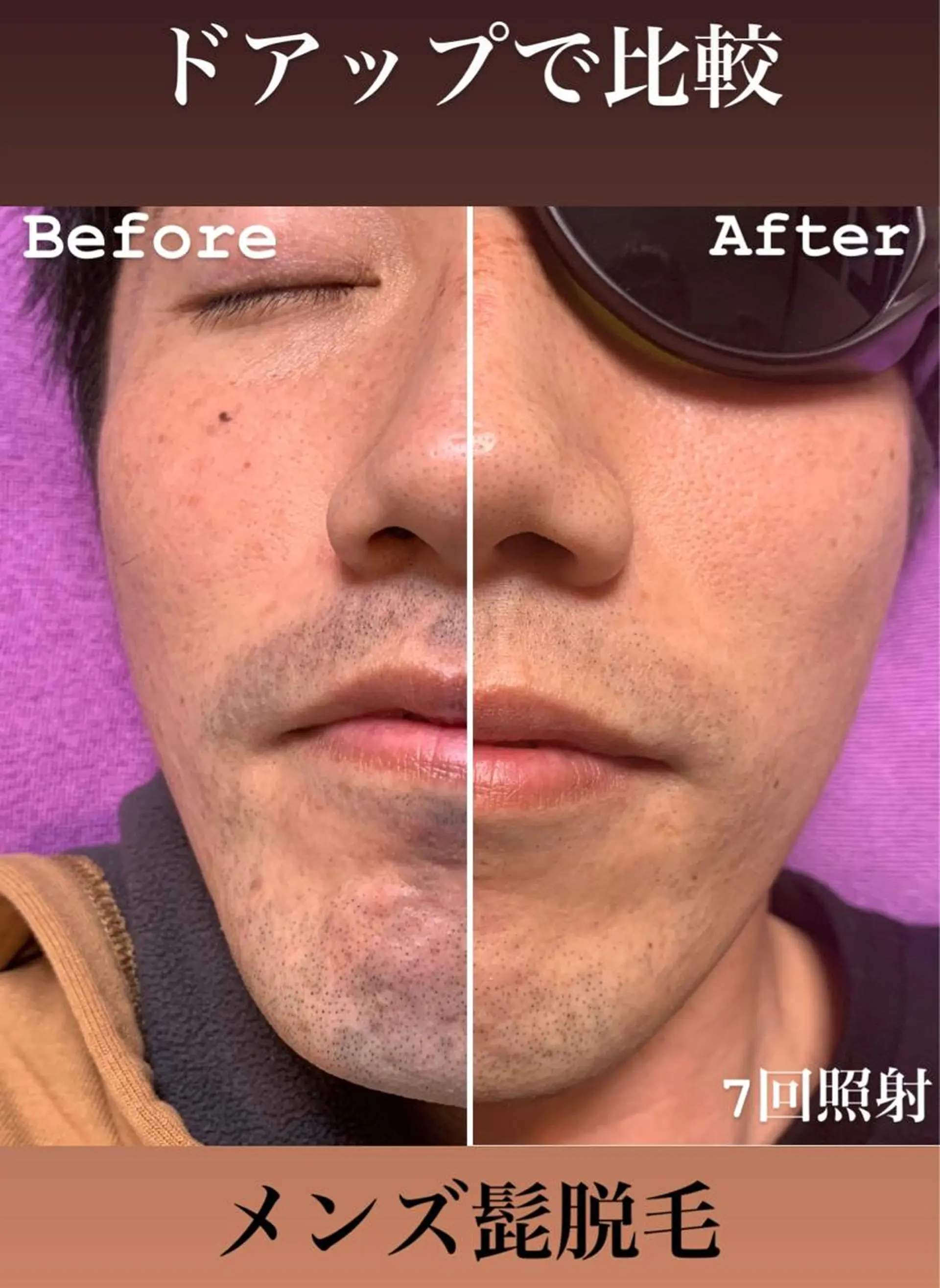 メンズ 脱毛＆エステサロン【アンリミット】所属・森谷 莉美のエステ・リラクイメージ