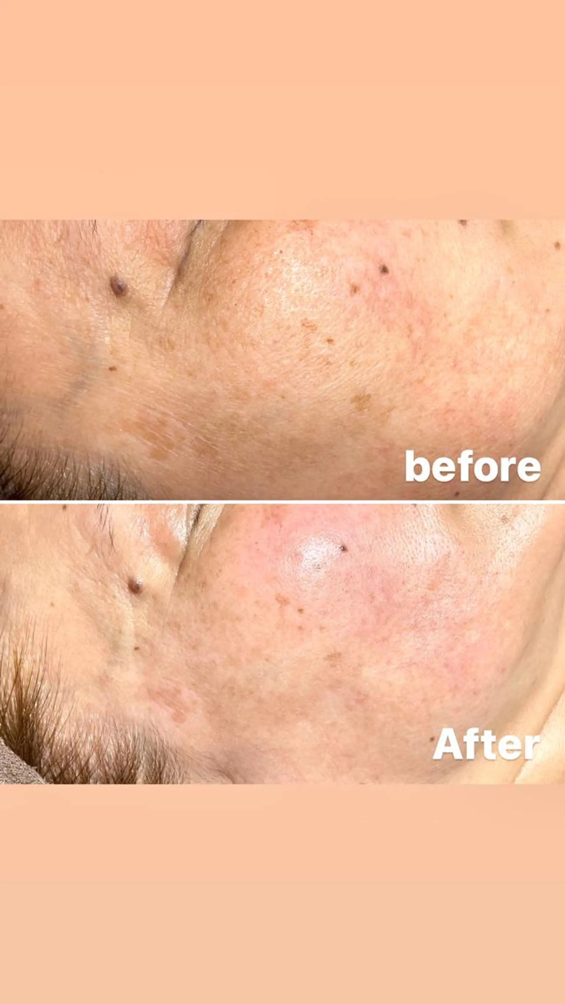 アヴニール プライベートサロンのその他イメージ