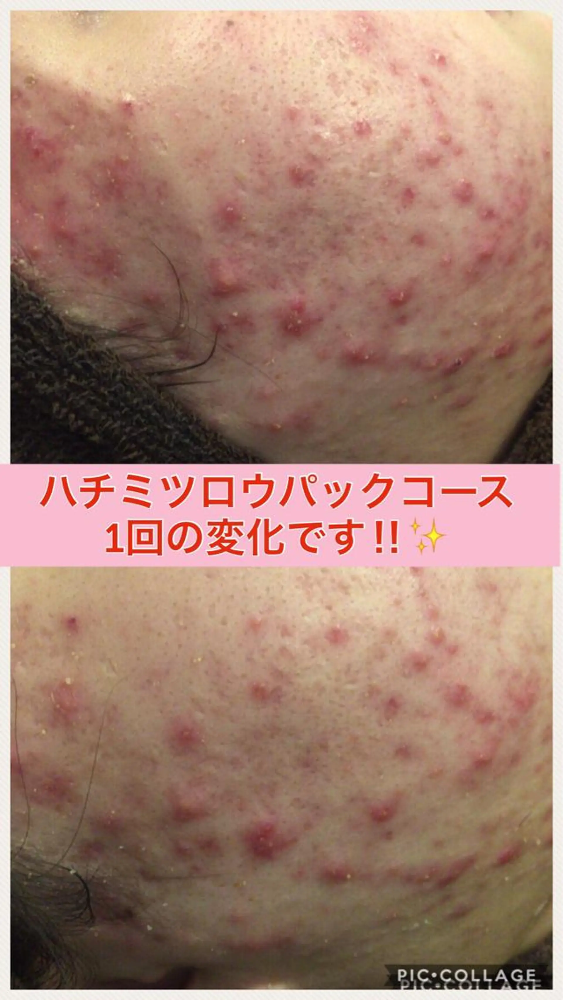 ミディアム カラー パーマ ヘアアレンジ メンズ キッズ ネイル マツエク・マツパ ニキビ・肌質改善専門 ♡人生が変わるサロンのエステ・リラクイメージ