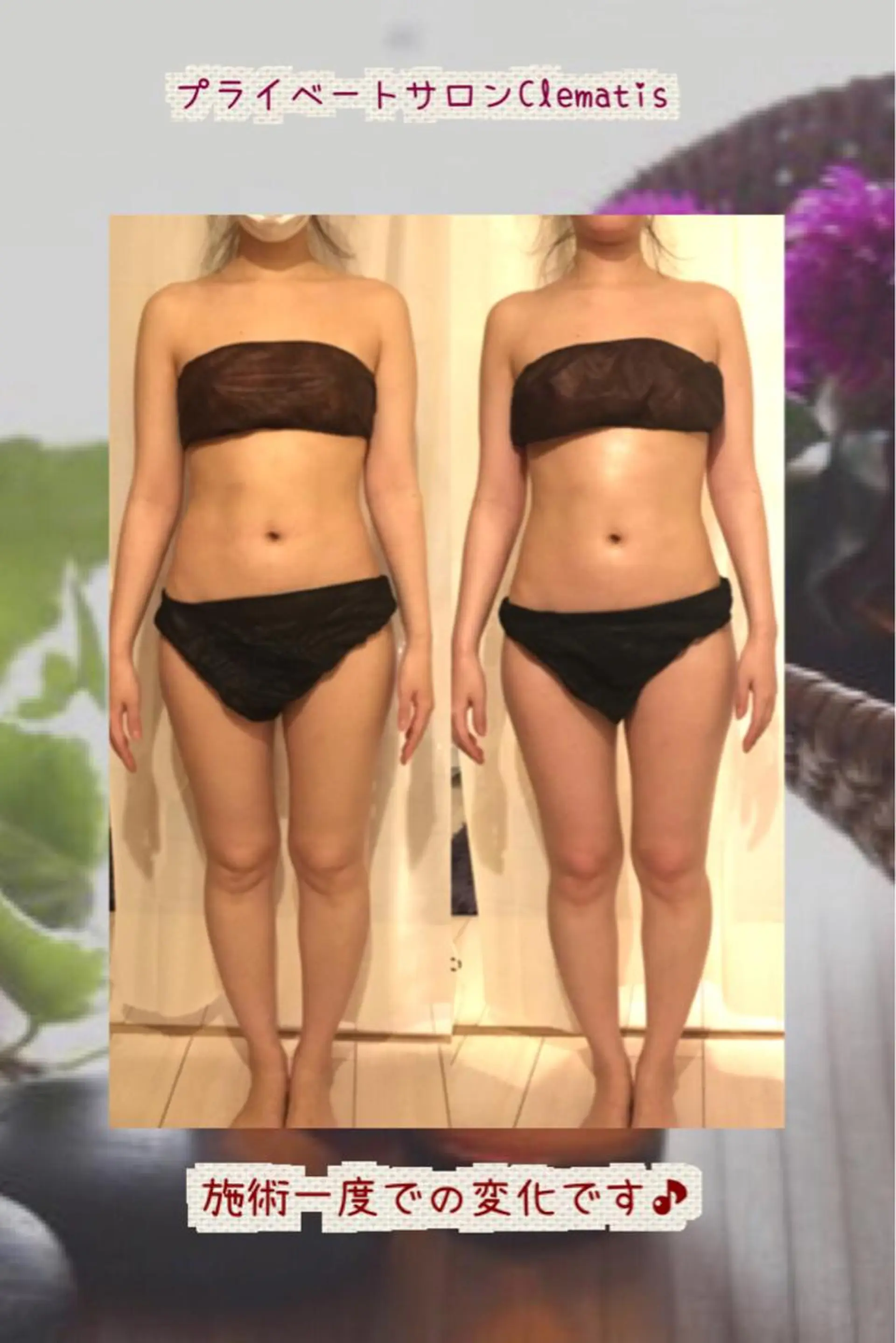 ショート カラー パーマ ヘアアレンジ メンズ キッズ ネイル マツエク・マツパ 強圧オールハンド痩身&黄土よもぎ蒸しプライベートサロンClematis池袋所属・強圧オールハンド痩身 片野のエステ・リラクイメージ