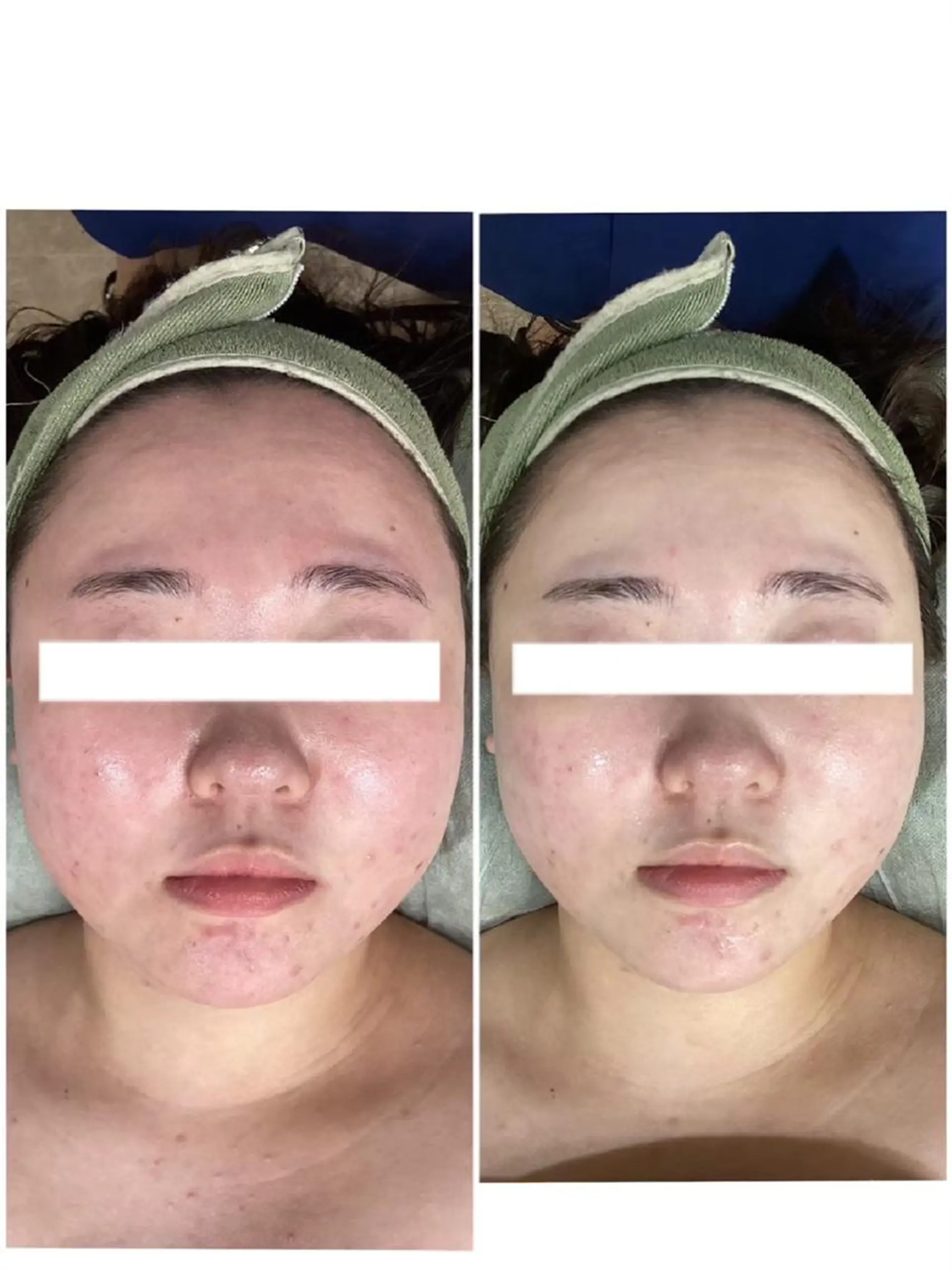 レイビス盛岡店 ♡吉田♡のエステ・リラクイメージ