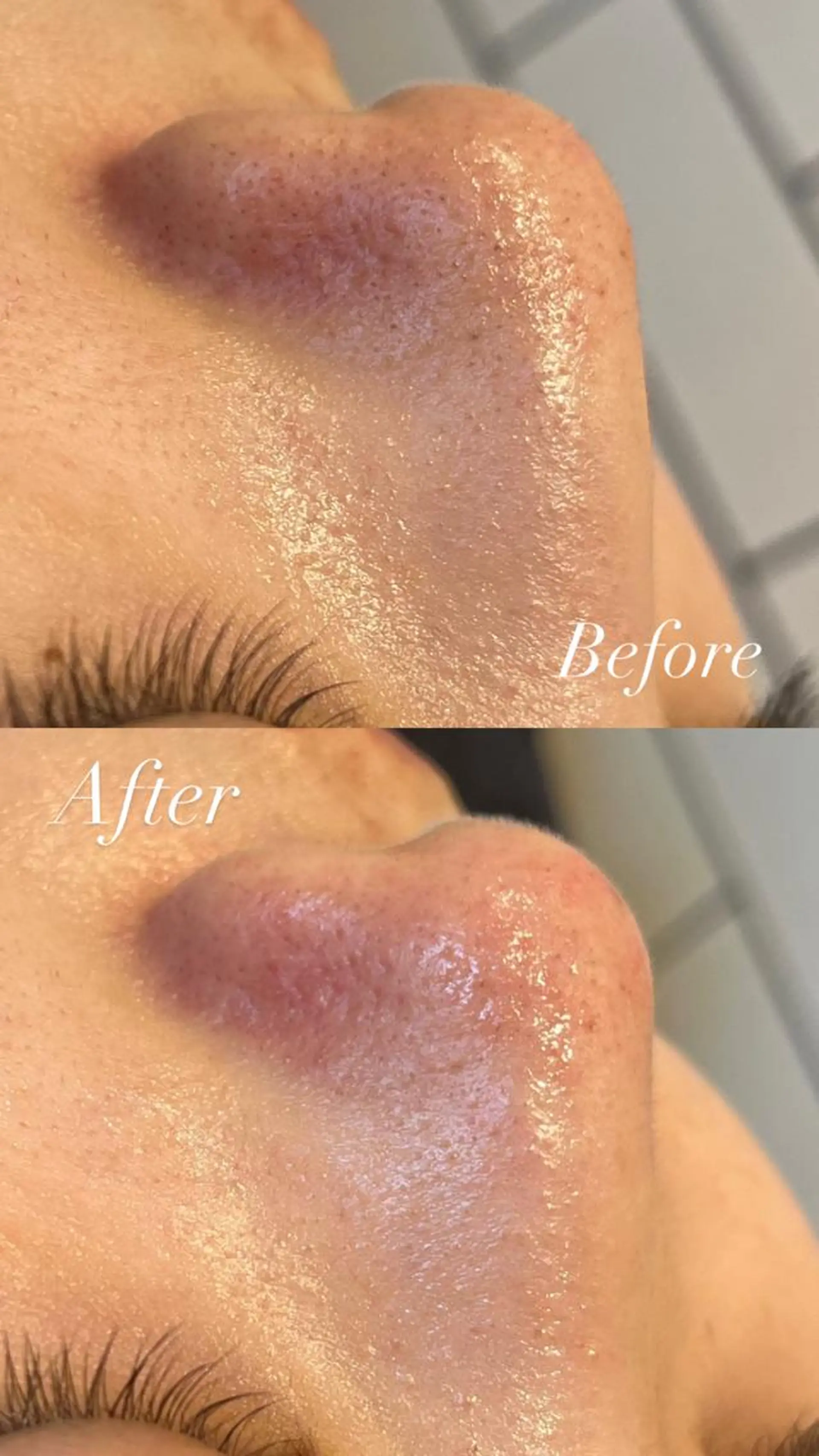 Lilyboo 多田のエステ・リラクイメージ