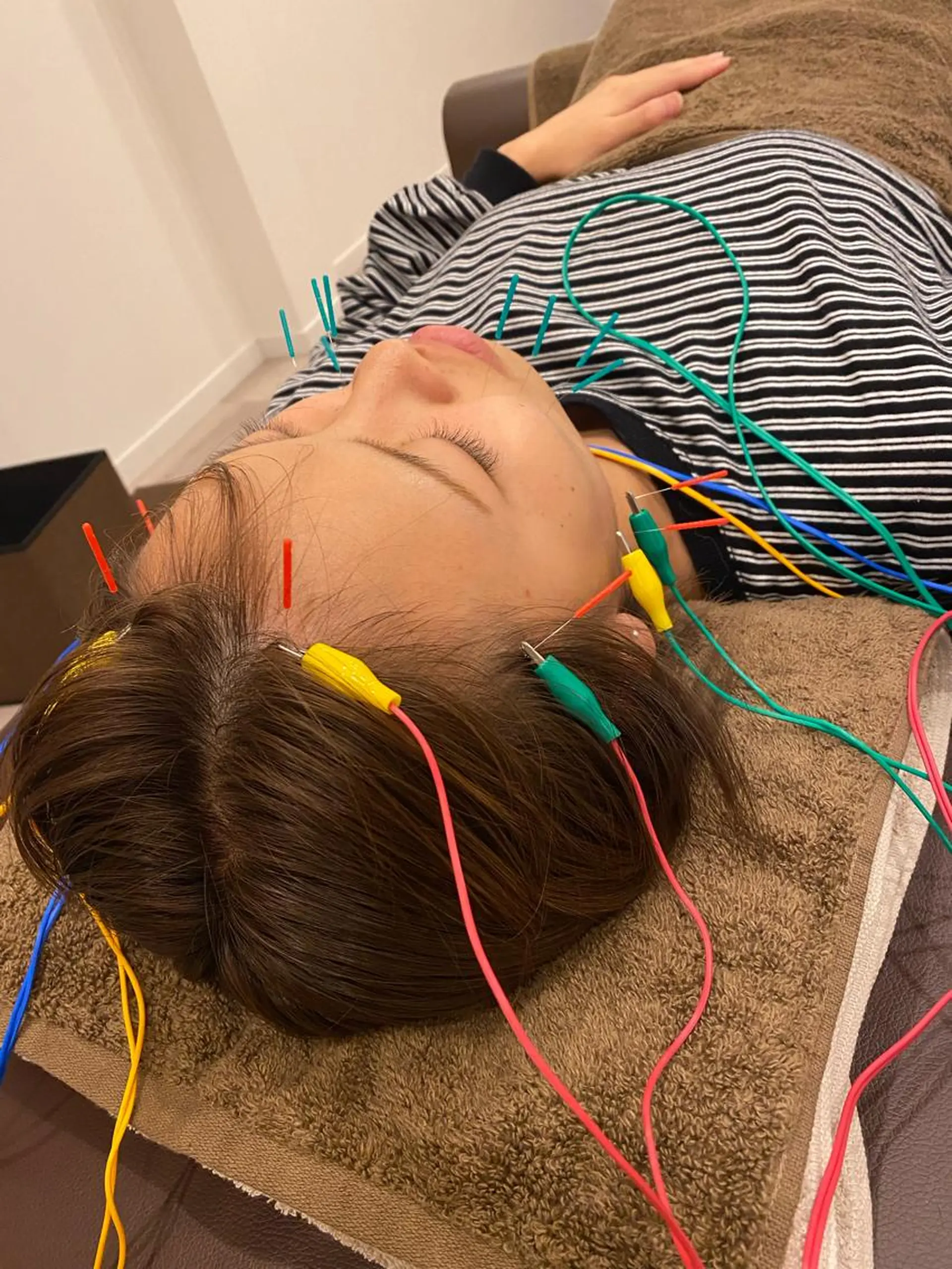 エステ リラク 肌質改善×美容鍼 ゆいのエステ・リラクイメージ