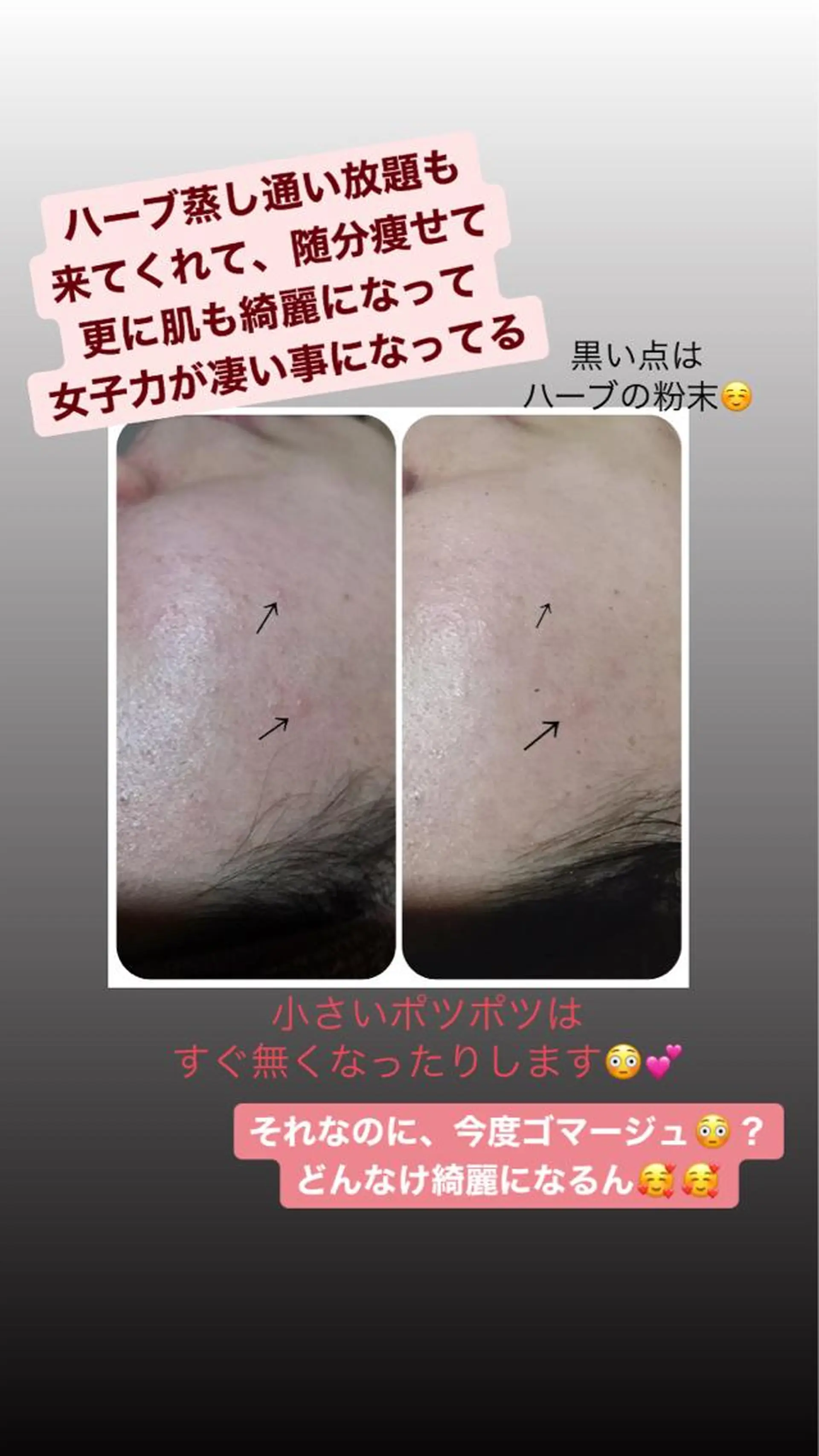 エステ 【足圧】鬼👹リンパ 身体整うサロンのエステ・リラクイメージ