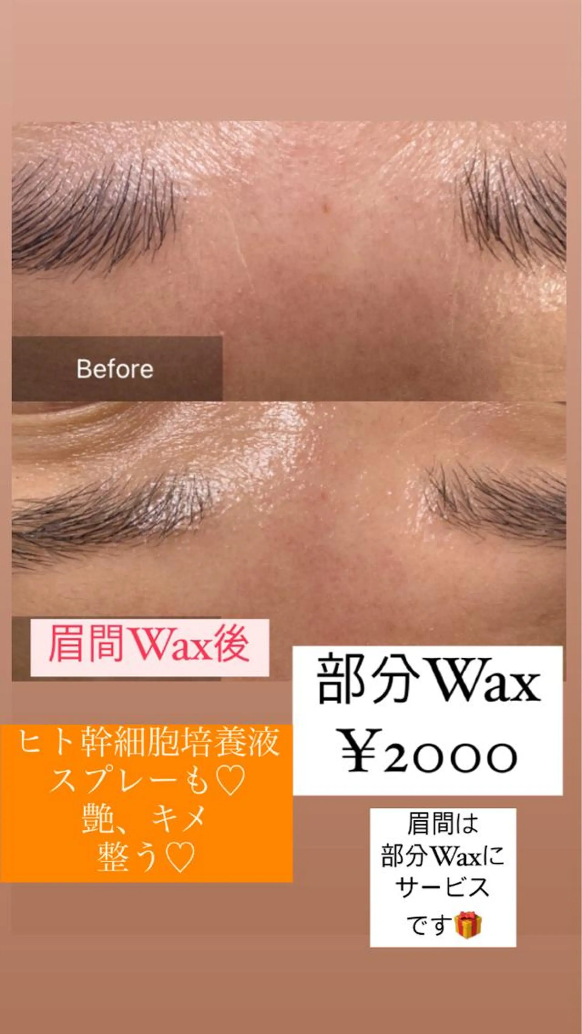 脱毛 産毛専門店 Bittoのエステ・リラクイメージ