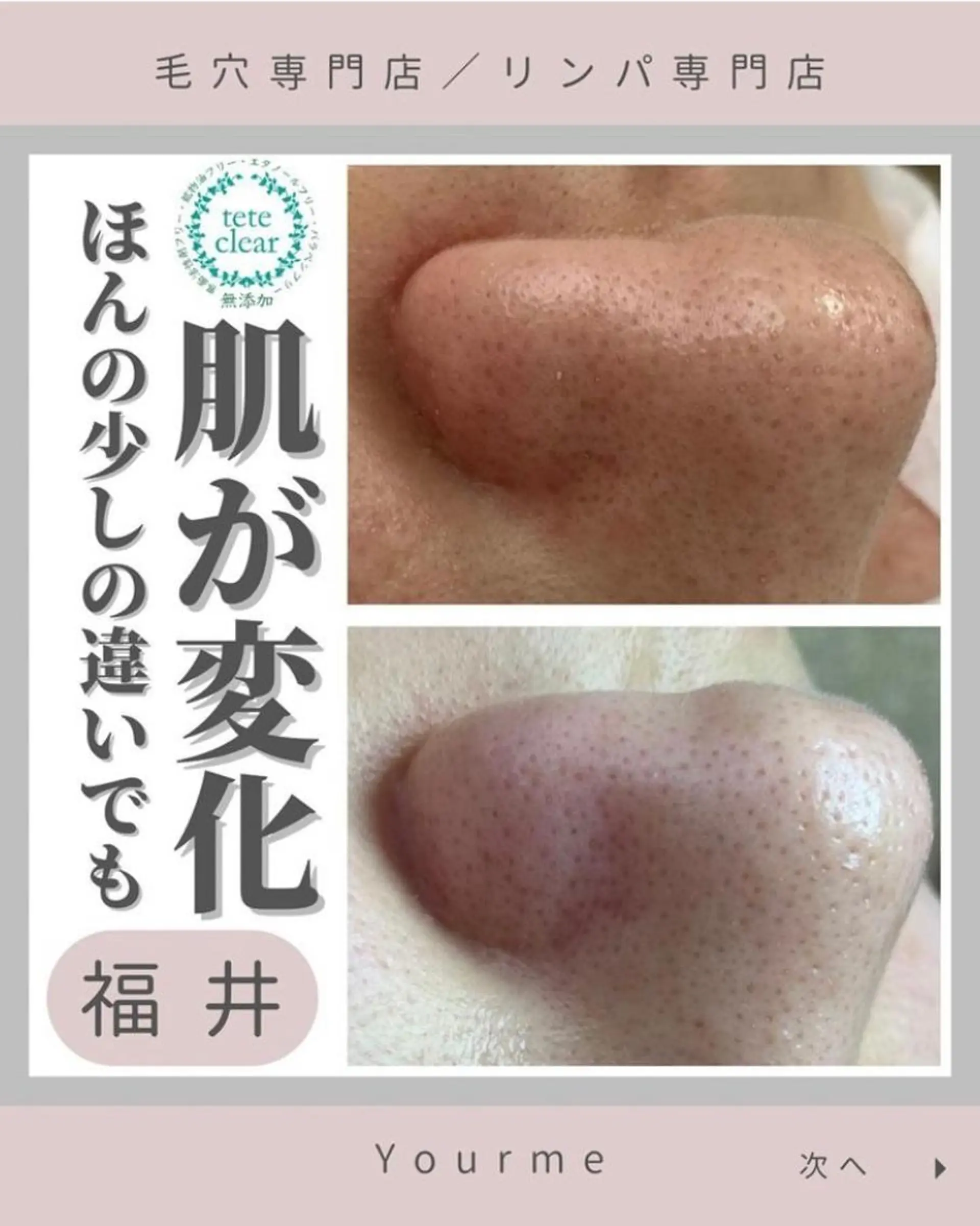 毛穴肌質ケアサロン Yourmeユアミーのエステ・リラクイメージ