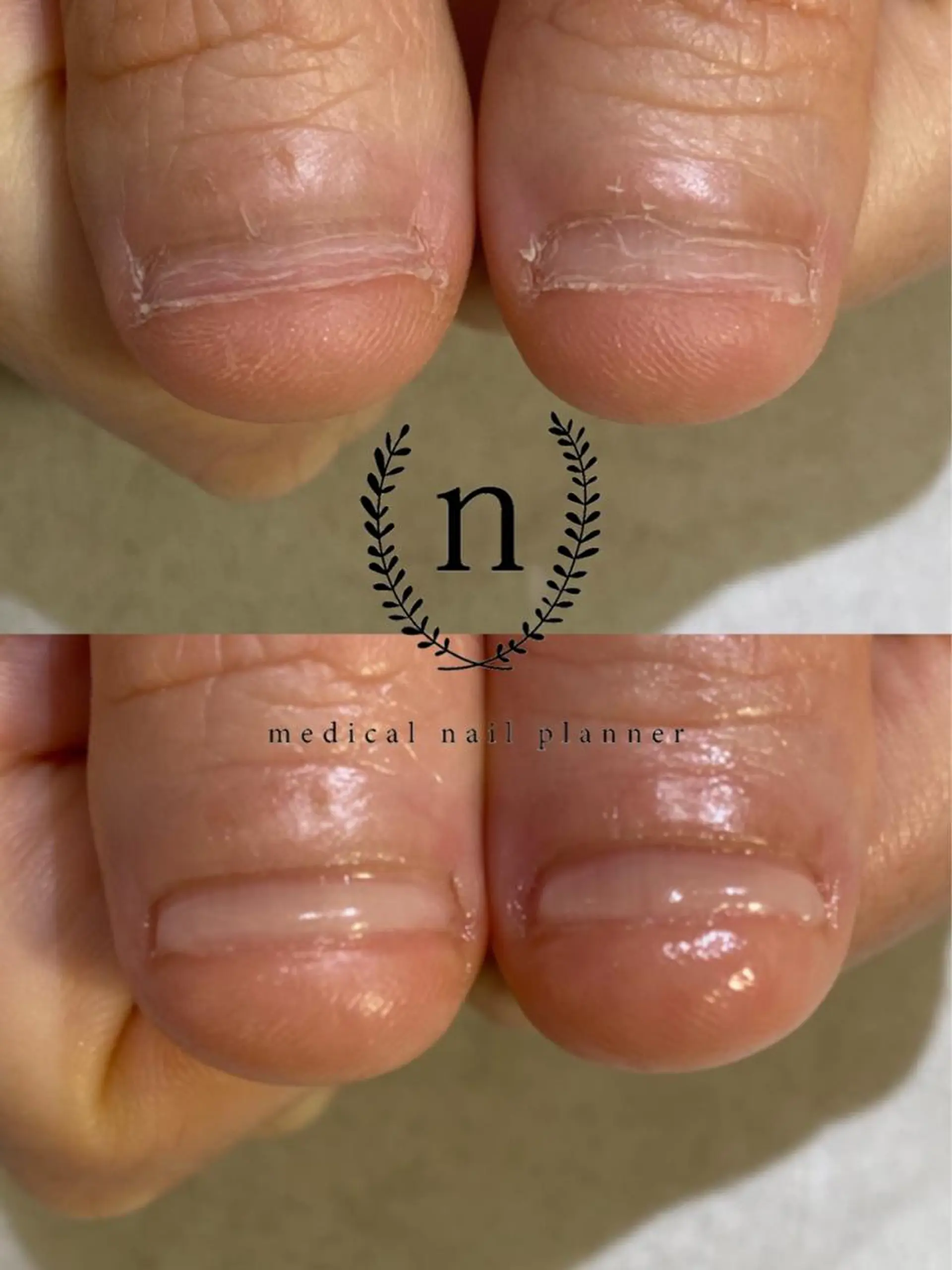 ネイル Rio 𓍼のネイルデザイン