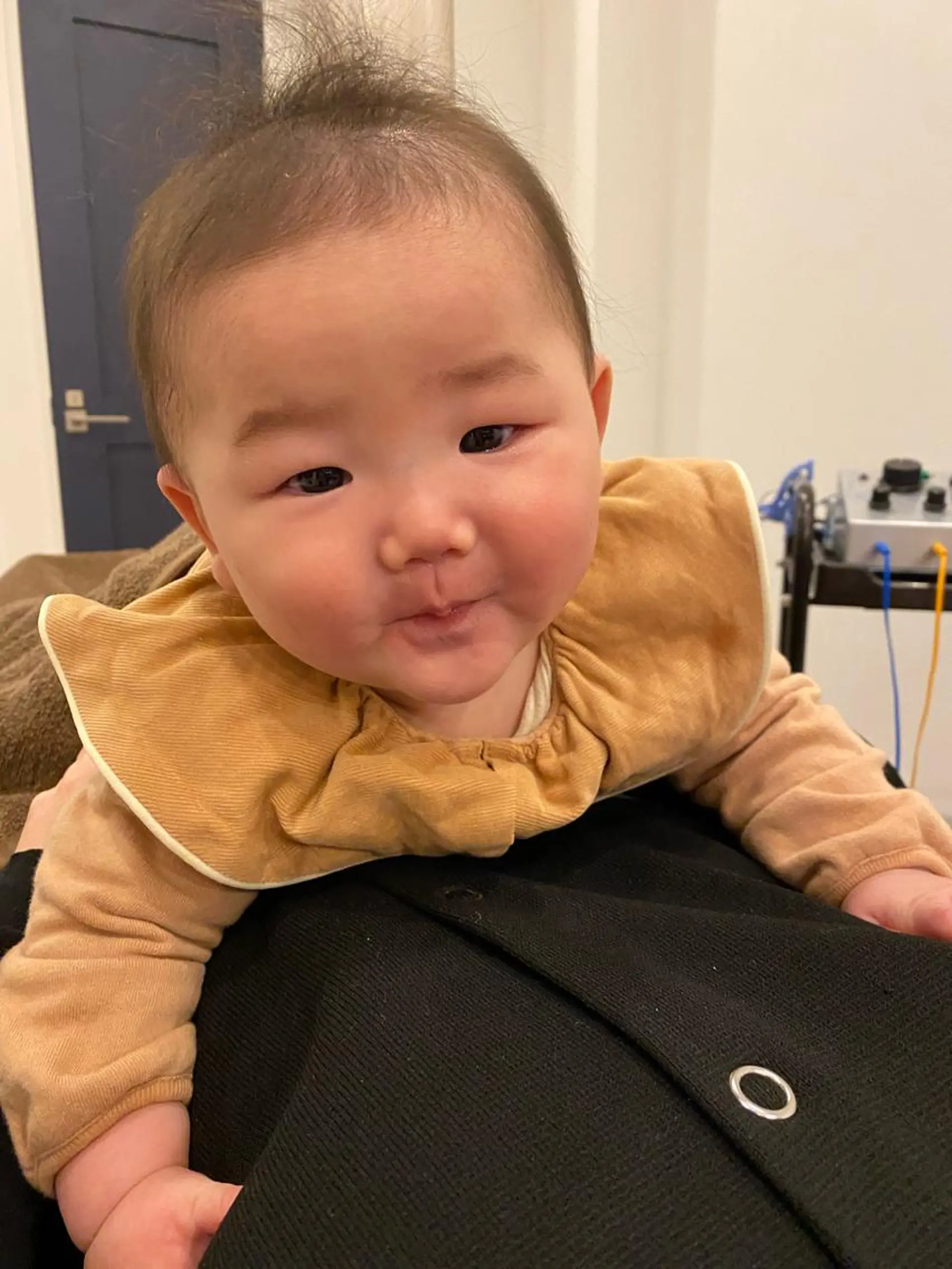 エステ リラク 美容鍼灸Solana所属・肌質改善×美容鍼 ゆいのエステ・リラクイメージ