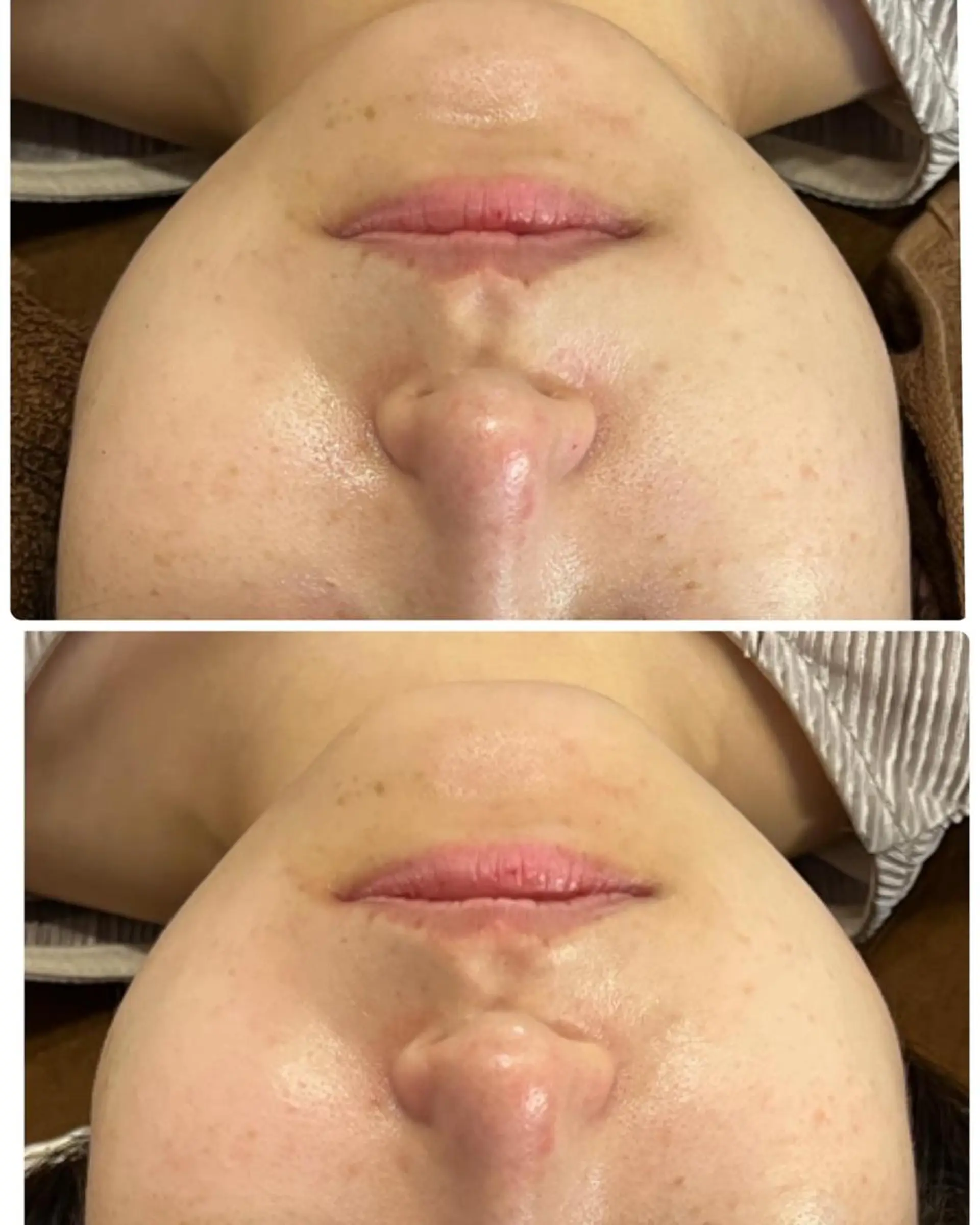 エステ FLEURフェイシャ ル🫧ハーブ🌿小顔のエステ・リラクイメージ